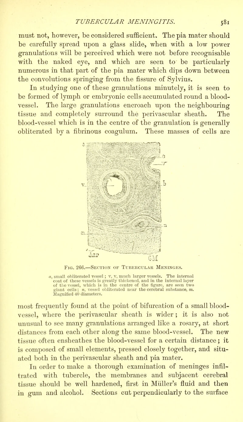 must not, however, be considered sufficient. The pia mater should be carefully spread upon a glass slide, when with a low power granulations will be perceived which were not before recognisable with the naked eye, and which are seen to be particularly numerous in that part of the pia mater which dips down between the convolutions springing from the fissure of Sylvius. In studying one of these granulations minutely, it is seen to be formed of lymph or embryonic cells accumulated round a blood- vessel. The large granulations encroach upon the neighbouring tissue and completely surround the perivascular sheath. The blood-vessel which is in the centre of the granulation is generally obliterated by a fibrinous coagulum. These masses of cells are mMà tn. gplf \ '•• tf||| Fig. 266.—Section of Tubercular Meninges. a, small obliterated vessel ; v, v, much larger vessels. The internal coat of these vessels is greatly thickened, and in the internal layer of the vessel, which is in the centre of the figure, are seen two giant cells ; n, vessel obliterated near the cerebral substance, m. Magnified 40 diameters. most frequently found at the point of bifurcation of a small blood- vessel, where the perivascular sheath is wider ; it is also not unusual to see many granulations arranged like a rosary, at short distances from each other along the same blood-vessel. The new tissue often ensheathes the blood-vessel for a certain distance ; it is composed of small elements, pressed closely together, and situ- ated both in the perivascular sheath and pia mater. In order to make a thorough examination of meninges infil- trated with tubercle, the membranes and subjacent cerebral tissue should be well hardened, first in Miiller's fluid and then in gum and alcohol. Sections cut perpendicularly to the surface '—~r m vi-M