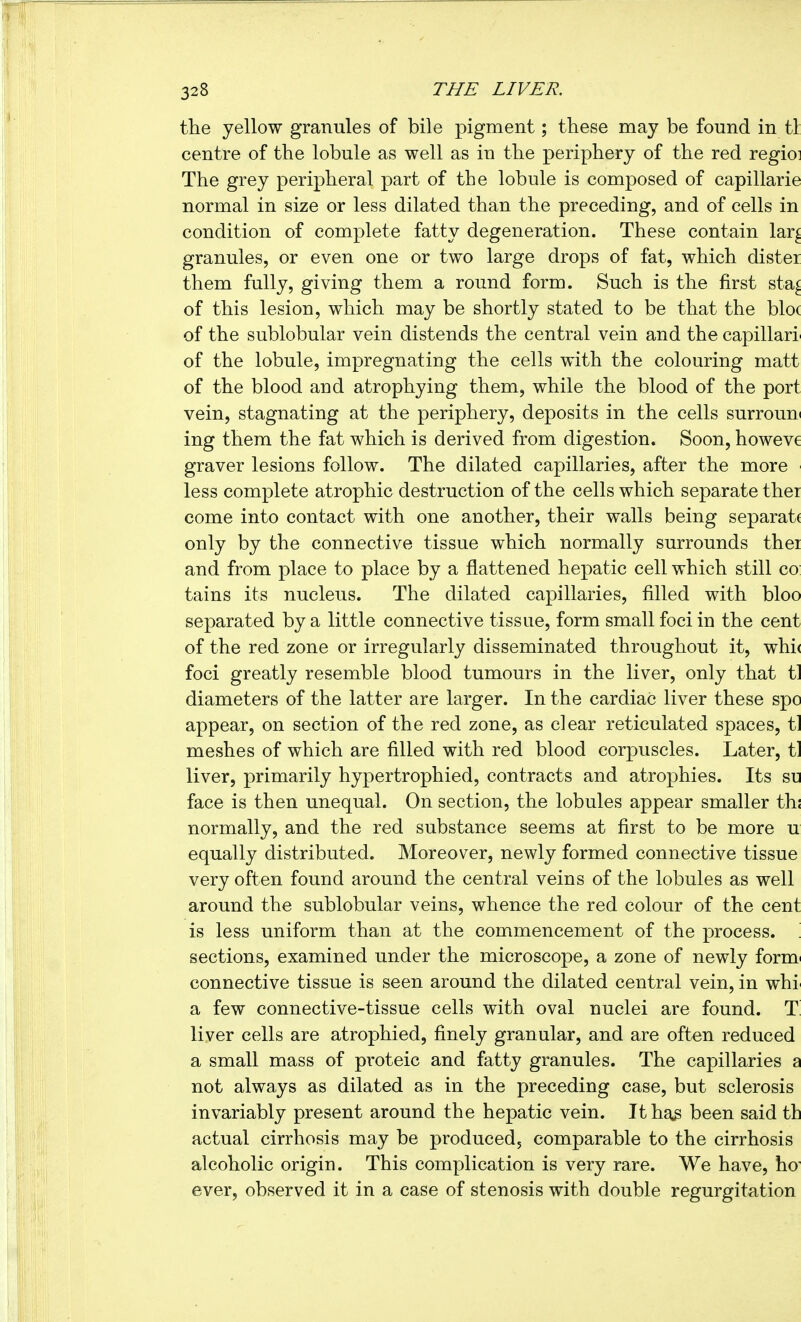 the yellow granules of bile pigment ; tliese may be found in tl centre of the lobule as well as in the periphery of the red regio: The grey peripheral part of the lobule is composed of capillarie normal in size or less dilated than the preceding, and of cells in condition of complete fatty degeneration. These contain lar^ granules, or even one or two large drops of fat, which dister them fully, giving them a round form. Such is the first sta^ of this lesion, which may be shortly stated to be that the bloc of the sublobular vein distends the central vein and the capillari of the lobule, impregnating the cells with the colouring matt of the blood and atrophying them, while the blood of the port vein, stagnating at the periphery, deposits in the cells surroun^ ing them the fat which is derived from digestion. Soon, howeve graver lesions follow. The dilated capillaries, after the more less complete atrophic destruction of the cells which separate ther come into contact with one another, their walls being separat( only by the connective tissue which normally surrounds thei and from place to place by a flattened hepatic cell which still co tains its nucleus. The dilated capillaries, filled with bloo separated by a little connective tissue, form small foci in the cent of the red zone or irregularly disseminated throughout it, whi( foci greatly resemble blood tumours in the liver, only that tl diameters of the latter are larger. In the cardiac liver these spo appear, on section of the red zone, as clear reticulated spaces, tl meshes of which are filled with red blood corpuscles. Later, tl liver, primarily hypertrophied, contracts and atrophies. Its se face is then unequal. On section, the lobules appear smaller th; normally, and the red substance seems at first to be more u equally distributed. Moreover, newly formed connective tissue very often found around the central veins of the lobules as well around the sublobular veins, whence the red colour of the cent is less uniform than at the commencement of the process, sections, examined under the microscope, a zone of newly form^ connective tissue is seen around the dilated central vein, in whi a few connective-tissue cells with oval nuclei are found. T liver cells are atrophied, finely granular, and are often reduced a small mass of proteic and fatty granules. The capillaries a not always as dilated as in the preceding case, but sclerosis invariably present around the hepatic vein. It has been said th actual cirrhosis may be produced, comparable to the cirrhosis alcoholic origin. This complication is very rare. We have, ho ever, observed it in a case of stenosis with double regurgitation
