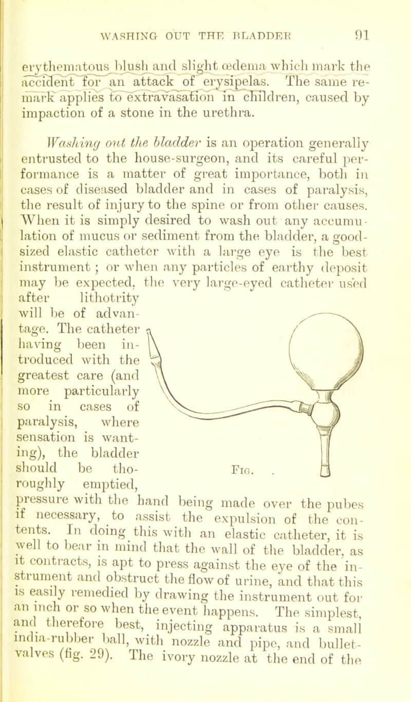 prvtliemntous lilush and slight oedema whieli mark the iici ident^'foT an attack of erysipelas. The same re- mark applies to extravasation in children, caused by impaction of a stone in the urethra. Wa^iliiny out the bladder is an operation generally entrusted to the house-surgeon, and its careful per- formance is a matter of great imjDortance, botli in cases of diseased bladder and in cases of paralysis, the result of injury to the spine or from other causes. When it is simply desired to wash out any accumu- lation of mucus or sediment from the bladder, a good- sized elastic catheter with a large eye is the best instrument ; or when any pai'ticles of earthy deposit may be expected, the very large-eyed cathetei- used after lithotrity Avill Ije of advan- tage. The catheter . having been in- 1\ troduced with the greatest care (and U more particularly so in cases of paralysis, where sensation is want- ing), the bladder should be tho- roughly emptied, pressure with the hand being made over the pubes if necessary, to assist the expulsion of the eon- tents. In doing this witli an elastic catheter, it is well to bear in mind that the wall of the bladder, as It contracts, is apt to press against the eye of the in- strument and obstruct the flow of urine, and that this IS easily remedied by drawing the instrument out for an inch or so when the event happens. The simplest and therefore best, injecting apparatus is a small HK la-rubber ball, with nozzle and pipe, and bullet- valves (fag. 29). The ivory nozzle at the end of the