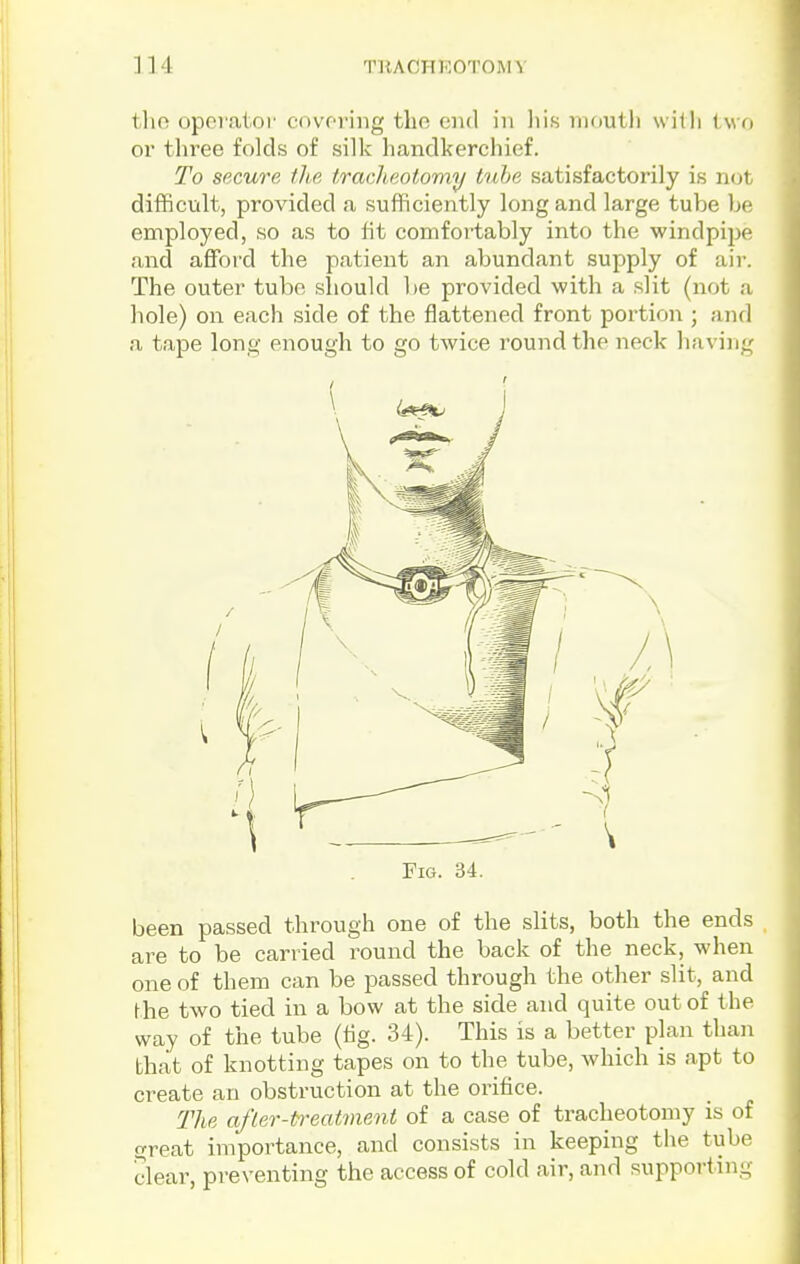 tho opoi'aiol' covoriiig tho end in his inoutli wiili iwa or three folds of silk handkerchief. To secure fhe traclieotomy tube satisfactorily is not difficult, provided a sufficiently long and large tube be employed, so as to fit comfortably into the windpipe and affijrd the patient an abundant supply of air. The outer tube sliould be provided with a slit (not a hole) on each side of the flattened front portion ; and a tape long enough to go twice round the neck having Fig. 34. been passed through one of the slits, both the ends are to be carried round the back of the neck, when one of them can be passed through the other slit, and the two tied in a bow at the side and quite out of the way of the tube (fig. 34). This is a better plan than that of knotting tapes on to the tube, which is apt to create an obstruction at the orifice. The afler-treatment of a case of traclieotomy is of great importance, and consists in keeping the tube clear, preventing the access of cold air, and supporting