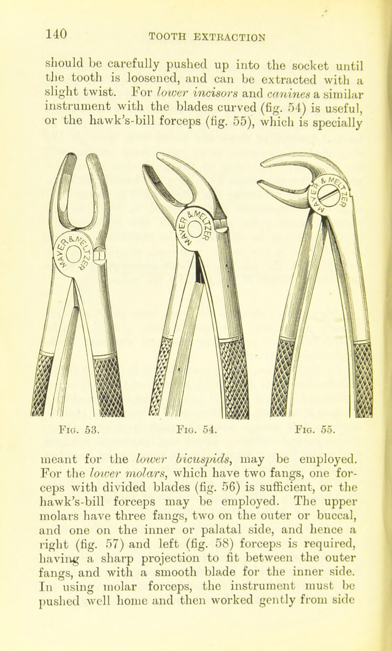 should be carefully pushed up into the socket until the tooth is loosened, and can be extracted with a slight twist. For lower incisors and canines a similar instrument with the blades curved (6g. 54) is useful, or the hawk's-bill forceps (lig. 55), which is specially Fig. 53. Fig. 54. Fig. 55. meant for the loiver bicitsjnds, may be employed. For the loioer molars, which have two fangs, one for- ceps with divided blades (fig. 56) is sufficient, or the hawk's-bill forceps may be employed. The upper molars have three fangs, two on the outer or buccal, and one on the inner or palatal side, and hence a right (fig. 57) and left (fig. 58) forceps is required, having a sharp projection to fit between the outer fangs, and with a smooth blade for the inner side. In using molar forceps, the instrument must be pushed well home and then worked gently from side