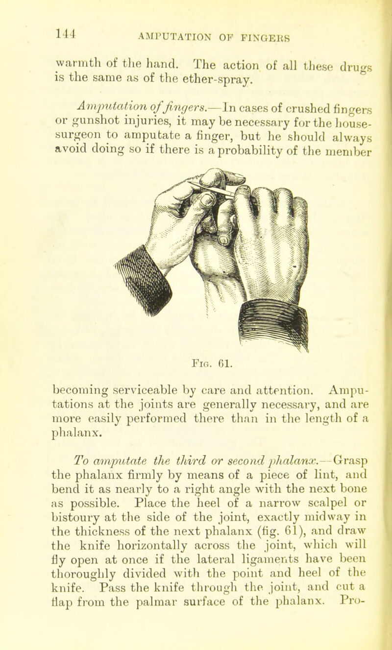 AMPUTATION OF FINGEKS warintli of tlie hand. The action of all these drugs is the same as of the ether-spray.  Ampulatio7i ofjingers.^lu cases of crushed fingers or gunshot injuries, it may be necessary for the house- surgeon to amputate a finger, but he should always avoid doing so if there is a probability of the member Fig. 61. becoming serviceable by care and attention. Ampu- tations at the joints are generally necesisary, and are more easily performed there than in the length of a phalanx. To amputate the third or second phalanx.—Grasp the phalanx firmly by means of a piece of lint, and bend it as nearly to a right angle with the next bone as possible. Place the heel of a narrow scalpel or bistoury at the side of the joint, exactly midway in the thickness of the next phalanx (fig. 61), and draw the knife horizontally across the joint, which will fiy open at once if the lateral ligaments have been thoroughly divided with the point and heel of the knife. Pass the knife through the joint, and cut a flap from the palmar surface of the phalanx. Pro-