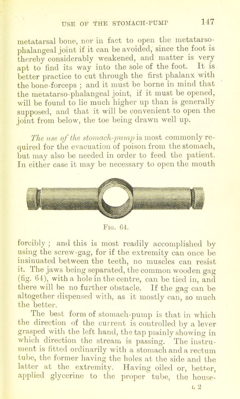 metatarsal bone, nor in fact to open the metatarso- phalangeal joint if it can be avoided, since the foot is thereby considerably weakened, and matter is very apt to find its way into the sole of the foot. It is better practice to cut through the first phalanx with the bone-forceps ; and it must be borne in mind that the metatarso-phalangeal joint, if it must be opened, will be found to lie much higher up than is generally supposed, and that it will be convenient to open the joint from below, the toe being drawn well up. The use of (he stomach-pump is most commonly re- quired for the evacuation of poison from the stomach, but may also be needed in order to feed the patient. In either case it may be necessary to open the mouth Fig. G4. forcibly ; and this is most readily accomjalished by using the screw-gag, for if the extremity can once be insinuated between the teeth, no muscles can resist it. The jaws being separated, the common wooden gag (fig. 64), with a hole in the centre, can be tied in, and there will be no further obstacle. If the gag can be altogether dispensed with, as it mostly can, so much the better. The best form of stoinach-pump is that in which the direction of the cui rent is controlled by a lever grasped with the left hand, the tap plainly showing in which direction the stream is passing. ' The instru- ment is fitted ordinarily with a stomach and a rectum tube, the former having the holes at tlie side and the latter at the extremity. Having oiled or, better, applied glycerine to tlic proper tuhe, the house- L 2