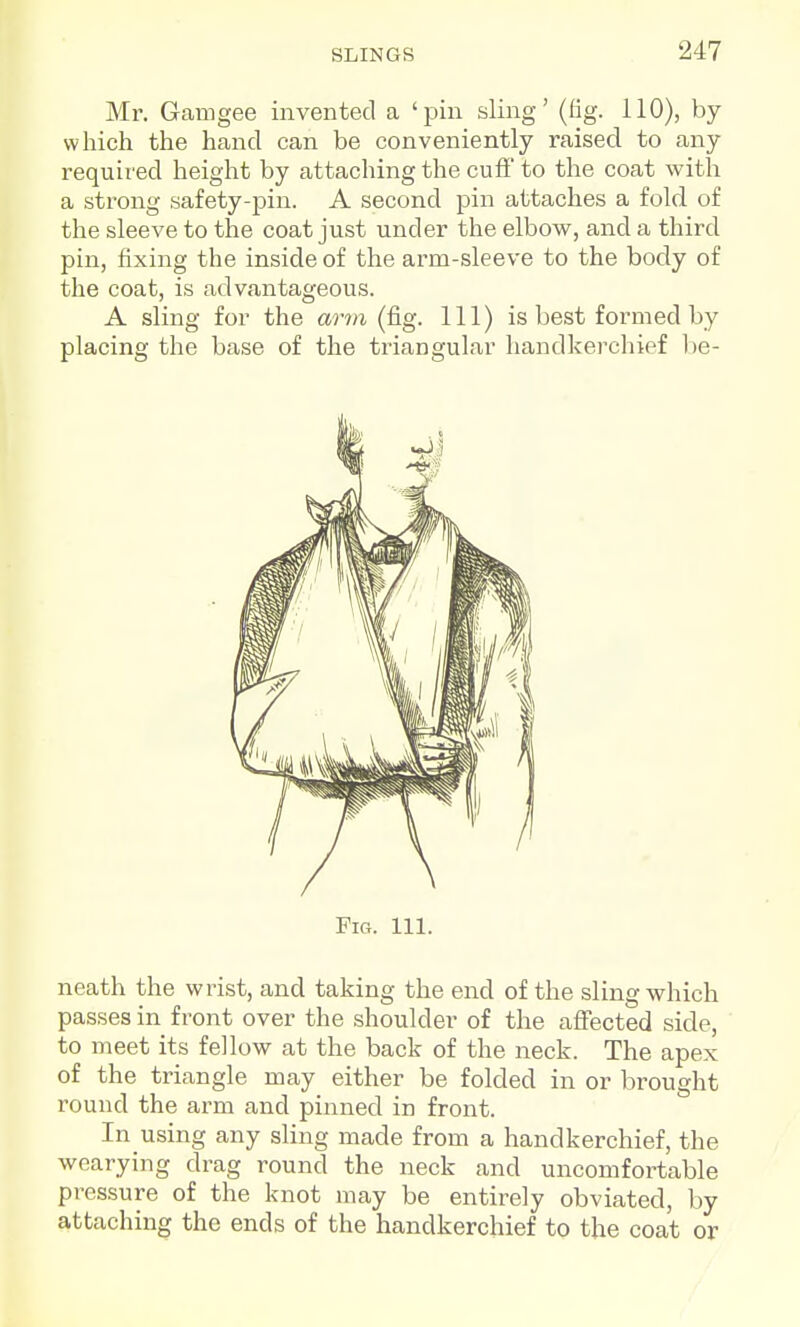 Mr. Gam gee invented a 'pin sling' (fig. 110), by which the hand can be conveniently raised to any required height by attaching the cufi' to the coat with a strong safety-pin. A second pin attaches a fold of the sleeve to the coat just under the elbow, and a third pin, fixing the inside of the arm-sleeve to the body of the coat, is advantageous. A sling for the arm (fig. Ill) is best formed by placing the base of the triangular handkercliief l)e- FlG. 111. neath the wrist, and taking the end of the sling which passes in front over the shoulder of the affected side, to meet its fellow at the back of the neck. The apex of the triangle may either be folded in or brought round the arm and pinned in front. In using any sling made from a handkerchief, the wearying drag round the neck and uncomfortable pressure of the knot may be entirely obviated, by attaching the ends of the handkerchief to the coat or