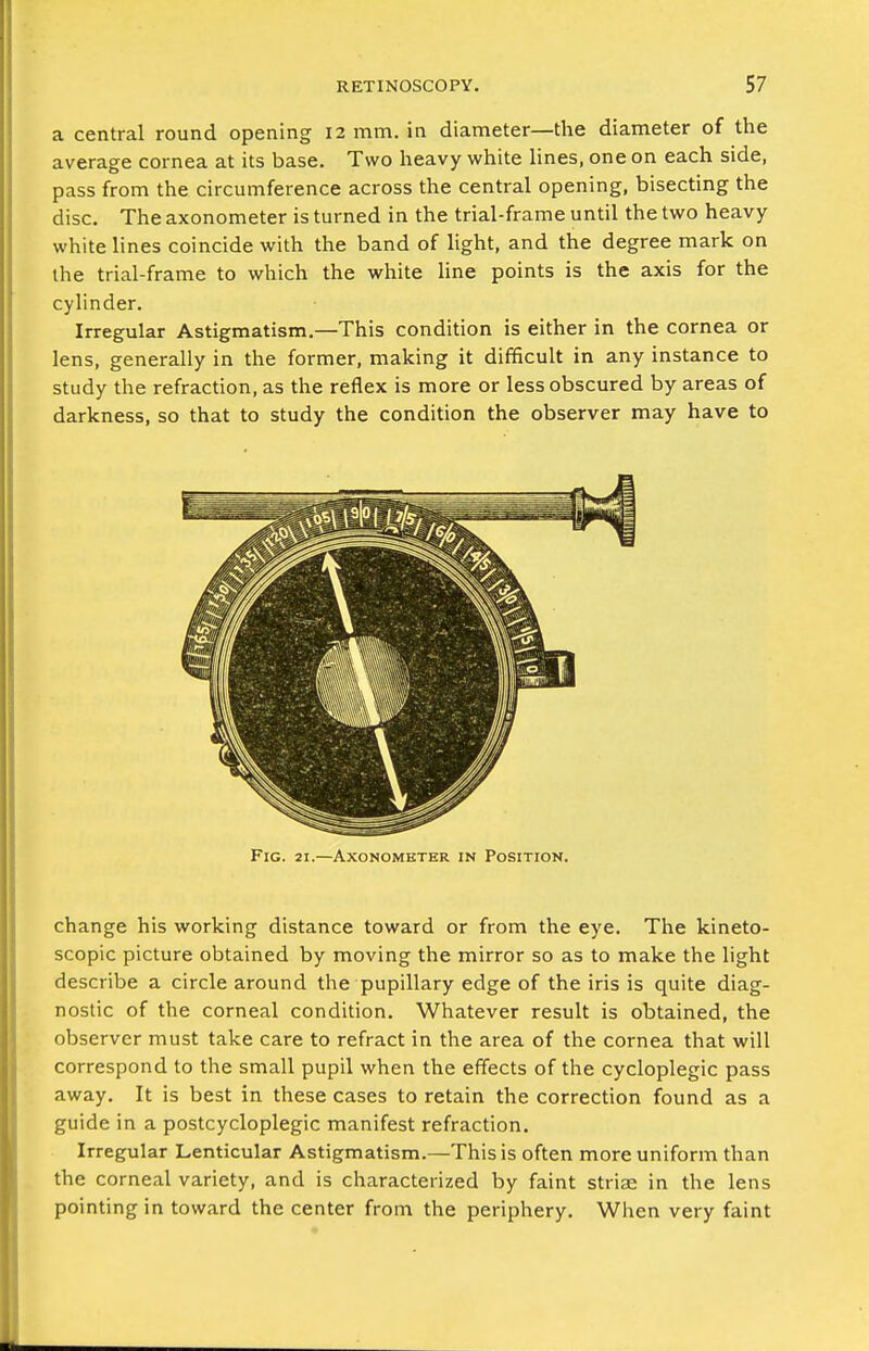 a central round opening 12 mm. in diameter—the diameter of the average cornea at its base. Two heavy white lines, one on each side, pass from the circumference across the central opening, bisecting the disc. The axonometer is turned in the trial-frame until the two heavy white lines coincide with the band of light, and the degree mark on the trial-frame to which the white line points is the axis for the cylinder. Irregular Astigmatism.—This condition is either in the cornea or lens, generally in the former, making it difficult in any instance to study the refraction, as the reflex is more or less obscured by areas of darkness, so that to study the condition the observer may have to Fig. 21.—Axonometer in Position. change his working distance toward or from the eye. The kineto- scopic picture obtained by moving the mirror so as to make the light describe a circle around the pupillary edge of the iris is quite diag- nostic of the corneal condition. Whatever result is obtained, the observer must take care to refract in the area of the cornea that will correspond to the small pupil when the effects of the cycloplegic pass away. It is best in these cases to retain the correction found as a guide in a postcycloplegic manifest refraction. Irregular Lenticular Astigmatism.—This is often more uniform than the corneal variety, and is characterized by faint striae in the lens pointing in toward the center from the periphery. When very faint