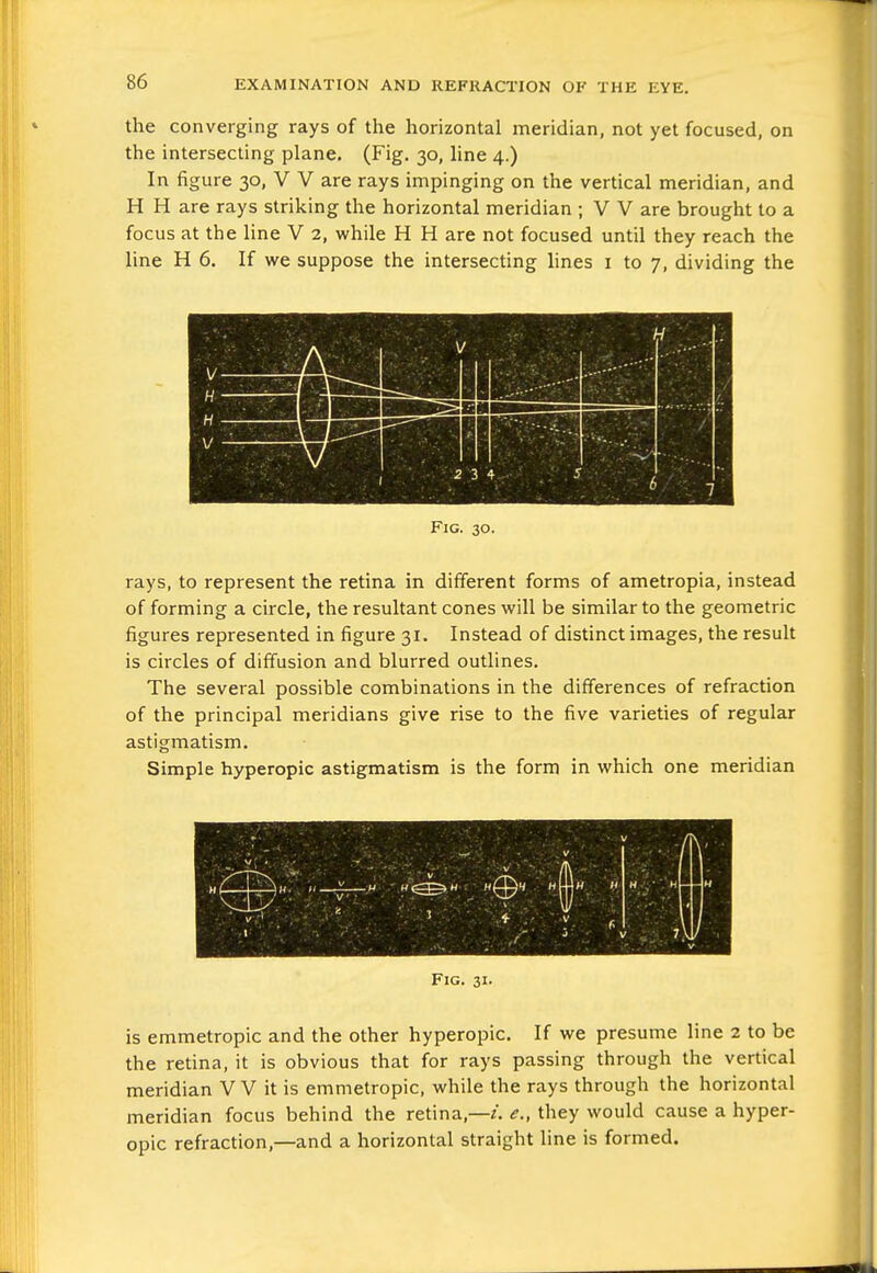 the converging rays of the horizontal meridian, not yet focused, on the intersecting plane, (Fig. 30, line 4.) In figure 30, V V are rays impinging on the vertical meridian, and H H are rays striking the horizontal meridian ; V V are brought to a focus at the line V 2, while H H are not focused until they reach the line H 6. If we suppose the intersecting lines i to 7, dividing the Fig. 30. rays, to represent the retina in different forms of ametropia, instead of forming a circle, the resultant cones will be similar to the geometric figures represented in figure 31. Instead of distinct images, the result is circles of diffusion and blurred outlines. The several possible combinations in the differences of refraction of the principal meridians give rise to the five varieties of regular astigmatism. Simple hyperopic astigmatism is the form in which one meridian Fig. 31. is emmetropic and the other hyperopic. If we presume line 2 to be the retina, it is obvious that for rays passing through the vertical meridian V V it is emmetropic, while the rays through the horizontal meridian focus behind the retina,—/. <?., they would cause a hyper- opic refraction,—and a horizontal straight line is formed.