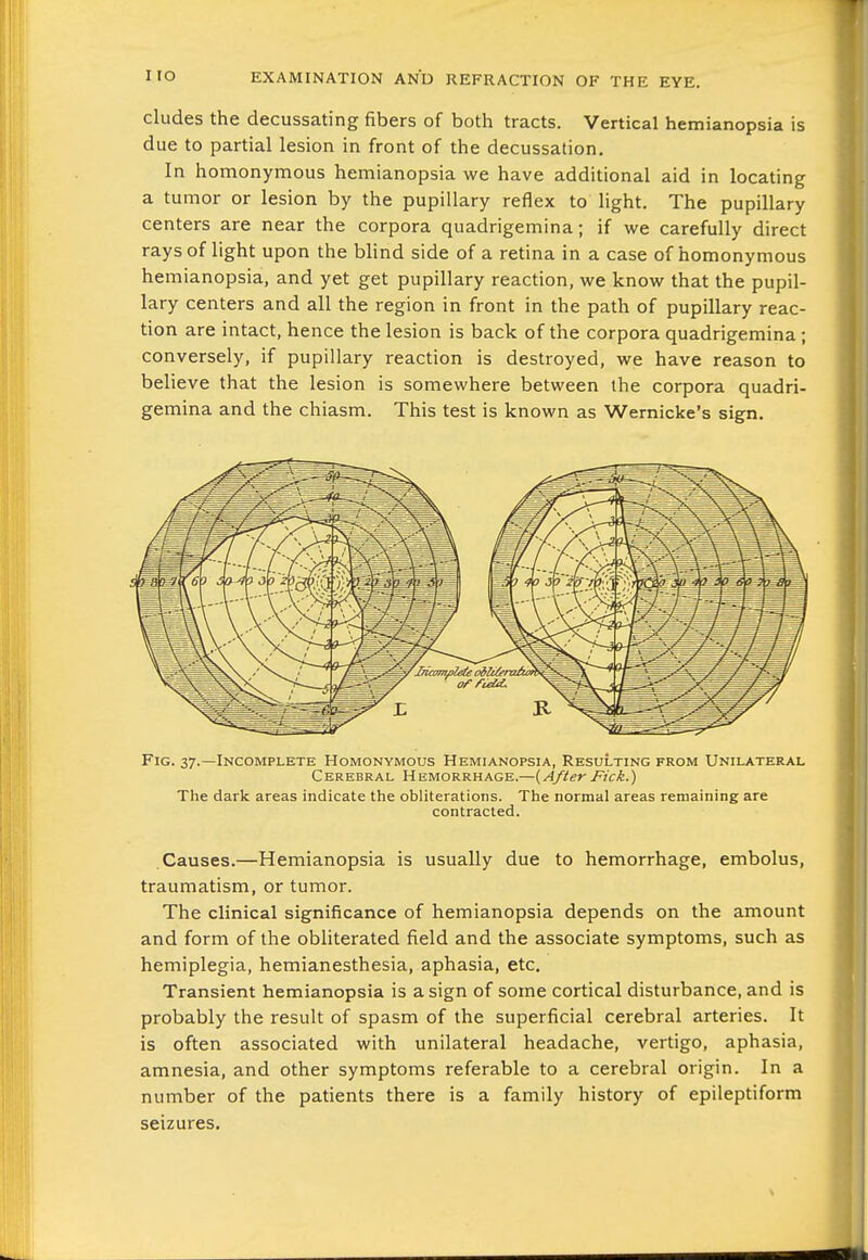 I lO eludes the decussating fibers of both tracts. Vertical hemianopsia is due to partial lesion in front of the decussation. In homonymous hemianopsia we have additional aid in locating a tumor or lesion by the pupillary reflex to light. The pupillary centers are near the corpora quadrigemina; if we carefully direct rays of light upon the Wind side of a retina in a case of homonymous hemianopsia, and yet get pupillary reaction, we know that the pupil- lary centers and all the region in front in the path of pupillary reac- tion are intact, hence the lesion is back of the corpora quadrigemina; conversely, if pupillary reaction is destroyed, we have reason to believe that the lesion is somewhere between the corpora quadri- gemina and the chiasm. This test is known as Wernicke's sign. Fig. 37.—Incomplete Homonymous Hemianopsia, ResuLting from Unilateral Cerebral Hemorrhage.—{AfterFick.) The dark areas indicate the obliterations. The normal areas remaining are contracted. Causes.—Hemianopsia is usually due to hemorrhage, embolus, traumatism, or tumor. The clinical significance of hemianopsia depends on the amount and form of the obliterated field and the associate symptoms, such as hemiplegia, hemianesthesia, aphasia, etc. Transient hemianopsia is a sign of some cortical disturbance, and is probably the result of spasm of the superficial cerebral arteries. It is often associated with unilateral headache, vertigo, aphasia, amnesia, and other symptoms referable to a cerebral origin. In a number of the patients there is a family history of epileptiform seizures.