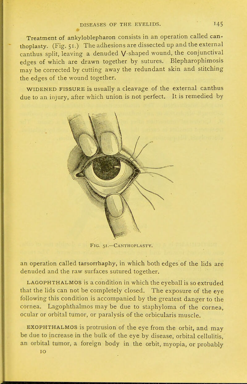 * Treatment of ankyloblepharon consists in an operation called can- thoplasty. (Fig. 51.) The adhesions are dissected up and the external canthus split, leaving a denuded V-shaped wound, the conjunctival edges of which are drawn together by sutures. Blepharophimosis may be corrected by cutting away the redundant skin and stitching the edges of the wound together. WIDENED FISSURE is usually a cleavage of the external canthus due to an injury, after which union is not perfect. It is remedied by Fig. 51.—Canthoplastv. an operation called tarsorrhaphy, in which both edges of the lids are denuded and the raw surfaces sutured together. LAGOPHTHALMOS is a condition in which the eyeball is so extruded that the lids can not be completely closed. The exposure of the eye following this condition is accompanied by the greatest danger to the cornea. Lagophthalmos may be due to staphyloma of the cornea, ocular or orbital tumor, or paralysis of the orbicularis muscle. EXOPHTHALMOS is protrusion of the eye from the orbit, and may be due to increase in the bulk of the eye by disease, orbital cellulitis, an orbital tumor, a foreign body in the orbit, myopia, or probably 10