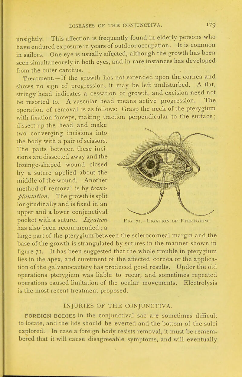 unsightly. This affection is frequently found in elderly persons who have endured exposure in years of outdoor occupation. It is common in sailors. One eye is usually affected, although the growth has been seen simultaneously in both eyes, and in rare instances has developed from the outer canthus. Treatment.—If the growth has not extended upon the cornea and shows no sign of progression, it may be left undisturbed. A flat, stringy head indicates a cessation of growth, and excision need not be resorted to. A vascular head means active progression. The operation of removal is as follows: Grasp the neck of the pterygium with fixation forceps, making traction perpendicular to the surface; dissect up the head, and make two converging incisions into ihe body with a pair of scissors. The parts between these inci- sions are dissected away and the lozenge-shaped wound closed by a suture applied about the middle of the wound. Another method of removal is by trans- plantation. The growth is split longitudinally and is fixed in an upper and a lower conjunctival pocket with a suture. Ligation has also been recommended ; a large part of the pterygium between the sclerocorneal margin and the base of the growth is strangulated by sutures in the manner shown in figure 71. It has been suggested that the whole trouble in pterygium lies in the apex, and curetment of the affected cornea or the applica- tion of the galvanocautery has produced good results. Under the old operations pterygium was liable to recur, and sometimes repealed operations caused limitation of the ocular movements. Electrolysis is the most recent treatment proposed. INJURIES OF THE CONJUNCTIVA. FOREIGN BODIES in the Conjunctival sac are sometimes difficult to locate, and the lids should be everted and the bottom of the sulci explored. In case a foreign body resists removal, it must be remem- bered that it will cause disagreeable symptoms, and will eventually Fig. 71.—Ligation of PterVgium.