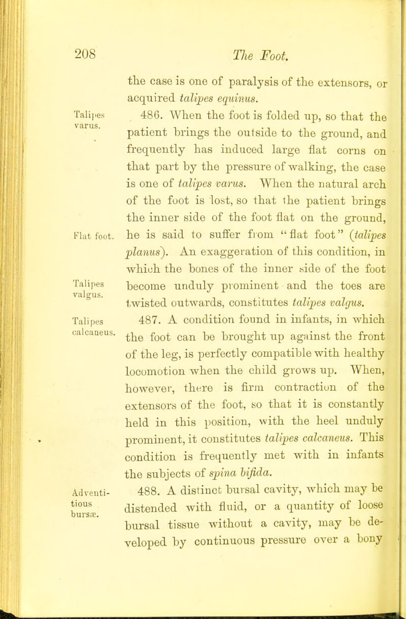 Talipes varus. Flat foot. Talipes valgus. Tali pes calcaneus. Adventi- tious bursa:. tlie case is one of paralysis of the extensors, or acquired talipes eqiiinus. 486. Wlien the foot is folded up, so that the patient brings the outside to the ground, and frequently has induced large flat corns on that part by the pressure of walking, the case is one of talipes varus. When the natural arch of the foot is lost, so that the patient brings the inner side of the foot flat on the ground, he is said to sufier from  flat foot (talipes planus). An exaggeration of this condition, in which the bones of the inner iside of the foot become unduly prominent and the toes are twisted outwards, constitutes talipes valgus. 487. A condition found in infants, in which the foot can be brought up against the front of the leg, is perfectly compatible with healthy locomotion when the child grows up. When, however, there is firm contraction of the extensors of the foot, so that it is constantly held in this position, with the heel unduly prominent, it constitutes talipes calcaneus. This condition is frequently met with in infants the subjects of sp>ina hijida. 488. A distinct bursal cavity, which may be distended with fluid, or a quantity of loose bursal tissue without a cavity, may be de- veloped by continuous pressure over a bony