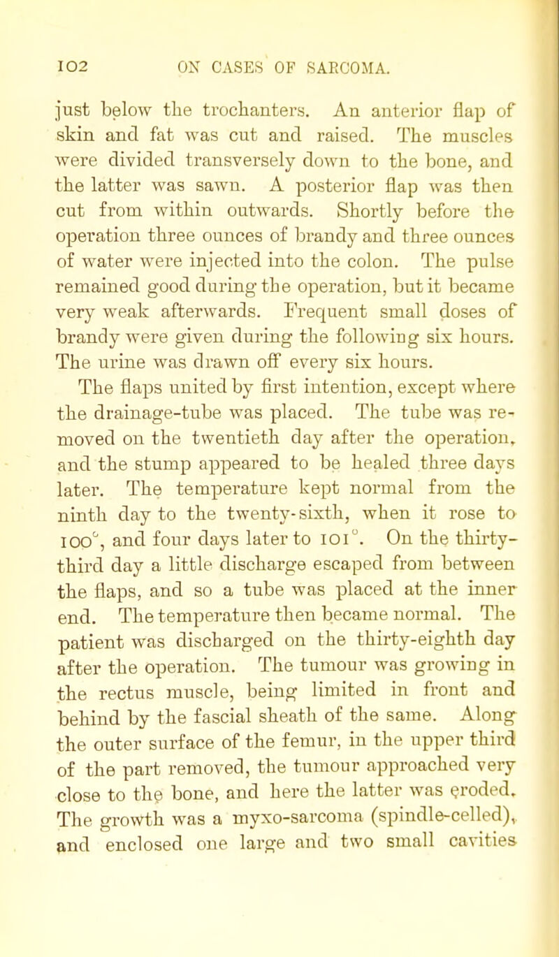 just below tlie trochanters. An anterior flap of skin and fat was cut and raised. The muscles were divided transversely down to the bone, and the latter was sawii. A posterior flap was then cut from within outwards. Shortly before the operation three ounces of brandy and three ounces of water were injected into the colon. The pulse remained good during the operation, but it became very weak afterwards. Frequent small doses of brandy were given during the following six hours. The urine was drawn off every six hours. The flaps united by first intention, except where the drainage-tube was placed. The tube was re- moved on the twentieth day after the operation, and the stump appeared to be healed three days later. The temperature kept normal from the ninth day to the twenty- sixth, when it rose to lOo'', and four days later to loi. On the thirty- third day a little discharge escaped from between the flaps, and so a tube was placed at the inner end. The temperature then became normal. The patient was discharged on the thirty-eighth day after the operation. The tumour was growing in the rectus muscle, being limited in front and behind by the fascial sheath of the same. Along the outer surface of the femur, in the upper third of the part removed, the tumour approached very close to the bone, and here the latter was (?roded. The growth was a myxo-sarcoma (spindle-celled), and enclosed one large and two small cavities