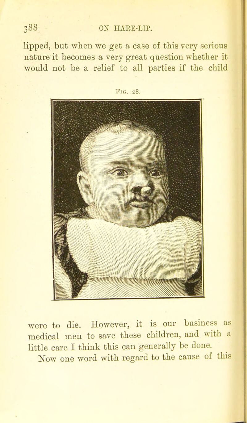 lipped, but wlien we get a case of this very serious nature it becomes a very great question whether it would not be a relief to all parties if the child Fic. 28. were to die. However, it is our business as medical men to save these children, and with a little care I think this can generally be done. Now one word with regard to the cause of this