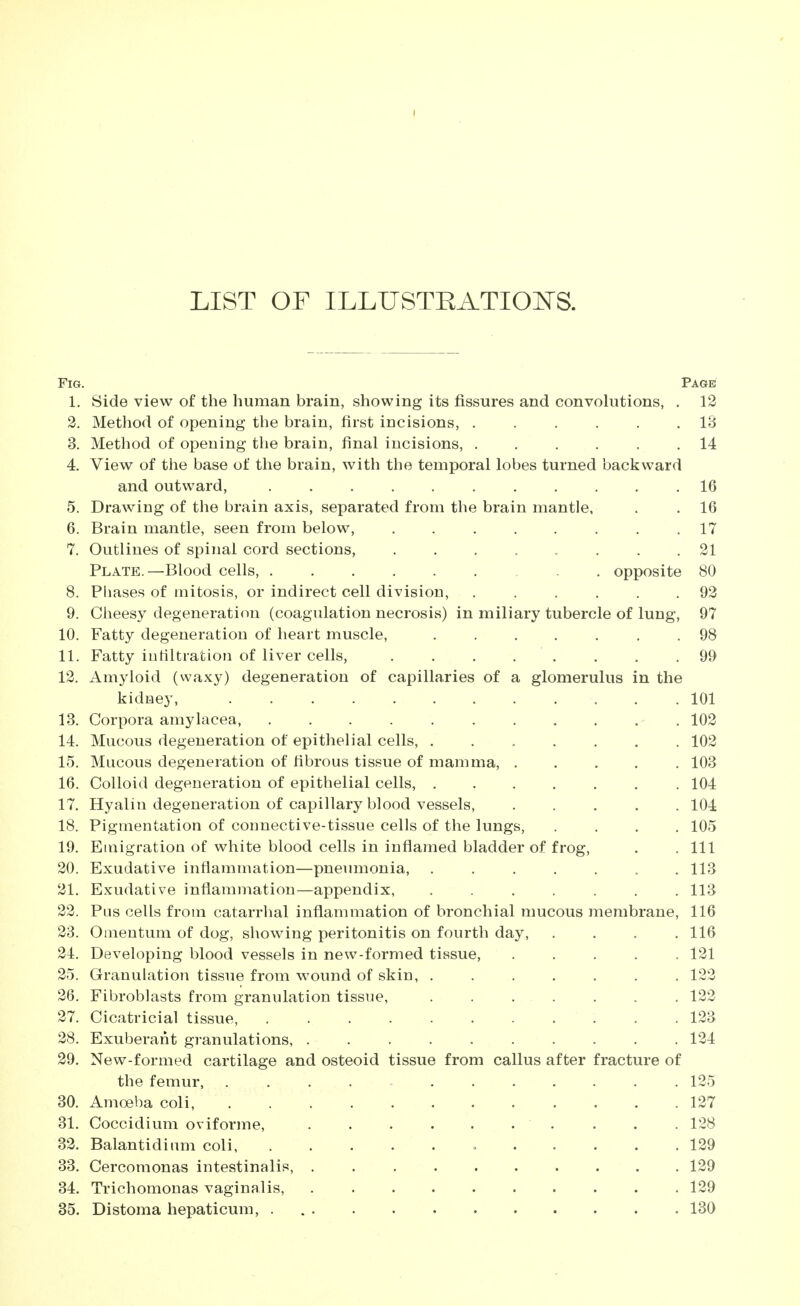 LIST OF ILLUSTRATIONS. Fig. Page 1. Side view of the human brain, showing its fissures and convolutions, . 12 2. Method of opening the brain, first incisions, ...... 13 3. Method of opening the brain, final incisions, ...... 14 4. View of the base of tlie brain, with the temporal lobes turned backward and outward, ........... 16 5. Drawing of the brain axis, separated from the brain mantle, . . 16 6. Brain mantle, seen from below, 17 7. Outlines of spinal cord sections, ........ 21 Plate.—Blood cells, opposite 80 8. Phases of mitosis, or indirect cell division, ...... 93 9. Clieesy degeneration (coagulation necrosis) in miliary tubercle of lung, 97 10. Fatty degeneration of heart muscle, ....... 98 11. Fatty iuHltration of liver cells, . 99 13. Amyloid (waxy) degeneration of capillaries of a glomerulus in the kidney, 101 13. Corpora amylacea, 103 14. Mucous degeneration of epithelial cells, ....... 103 15. Mucous degeneration of fibrous tissue of mamma, ..... 103 16. Colloid degeneration of epithelial cells, ....... 104 17. Hyalin degeneration of capillary blood vessels, ..... 104 18. Pigmentation of connective-tissue cells of the lungs, .... 105 19. Emigration of white blood cells in inflamed bladder of frog, . . Ill 30. Exudative inflammation—pneumonia, ....... 113 31. Exudative inflammation—appendix, ....... 113 33. Plis cells from catarrhal inflammation of bronchial mucous membrane, 116 33. Omentum of dog, showing peritonitis on fourth day, .... 116 34. Developing blood vessels in new-formed tissue, ..... 131 35. Granulation tissue from wound of skin, ....... 133 36. Fibroblasts from granulation tissue, 133 37. Cicatricial tissue, 133 38. Exuberant granulations, 134 39. New-formed cartilage and osteoid tissue from callus after fracture of the femur, ........... 135 30. Amoeba coli, 137 31. Coccidium oviforme, 128 33. Balantidium coli = 139 33. Cercomonas intestinalis, 139 34. Trichomonas vaginalis, 139 35. Distoma hepaticum, . 130