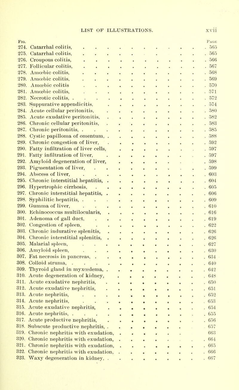 Fig. Page 274. Catarrhal colitis, 565 275. Catarrhal colitis, . ... 565 276. Croupous colitis, 566 277. Follicular colitis, 567 278. Amoebic colitis, 568 279. Arnosbic colitis, 569 280. Amoebic colitis 570 281. Amoebic colitis, 571 282. Necrotic colitis, 572 283. Suppurative appendicitis, 574 284. Acute cellular peritonitis, 580 285. Acute exudative peritonitis, 582 286. Chronic cellular peritonitis, . , 583 287. Chronic peritonitis, 585 288. Cystic papilloma of omentum, . 588 289. Clironic congestion of liver, 592 290. Fatty infiltration of liver cells, . 597 291. Fatty infiltration of liver, . 597 292. Amyloid degeneration of liver, . 598 293. Pigmentation of liver, , ... 599 294. Abscess of liver, 603 295. Chronic interstitial hepatitis, 604 296. Hypertrophic cirrhosis, 605 297. Chronic interstitial hepatitis, 606 298. Syphilitic hepatitis, . . , 609 299. Gumma of liver, 610 300. Echinococcus multilocularis 616 301. Adenoma of gall duct, 619 302. Congestion of spleen, 622 303. Chronic indurative splenitis, 626 304. Chronic interstitial splenitis, 626 305. Malarial spleen, 627 306. Amyloid spleen, 630 307. Fat necrosis in pancreas, 634 308. Colloid struma, 640 309. Thyroid gland in myxoedema, 642 310. Acute degeneration of kidney, 648 311. Acute exudative nephritis, 650 312. Acute exudative nephritis, 651 313. Acute nephritis, 652 314. Acute nephritis, 653 315. Acute exudative nephritis, 654 316. Acute nephritis, 655 317. Acute productive nephritis, ..••••* c . 656 318. Subacute productive nephritis, , 657 319. Chronic nephritis with exudation, 663 320. Chronic nephritis with exudation, . 664 321. Chronic nephritis with exudation, 665 322. Chronic nephritis with exudation, 666 323. Waxy degeneration in kidney, 667