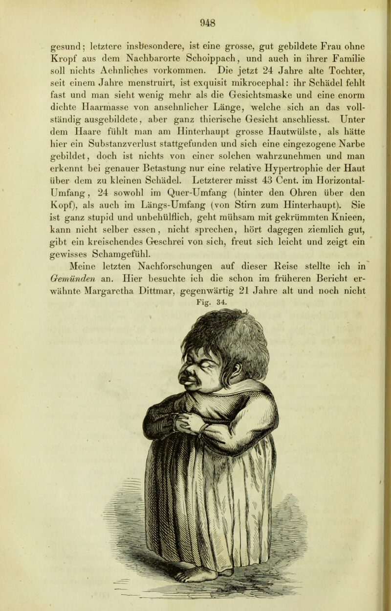 gesund; letztere insbesondere, ist eine grosse, gut gebildete Frau ohne Kropf aus dem Nachbarorte Schoippach, und auch in ihrer Familie soll nichts Aehnliches vorkommen. Die jetzt 24 Jahre alte Tochter, seit einem Jahre menstruirt, ist exquisit mikrocephal: ihr Schädel fehlt fast und man sieht wenig mein* als die Gesichtsmaske und eine enorm dichte Haarmasse von ansehnlicher Länge, welche sich an das voll- ständig ausgebildete, aber ganz thierische Gesicht anschliesst. Unter dem Haare fühlt man am Hinterhaupt grosse Hautwülste, als hätte hier ein Substanzverlust stattgefunden und sich eine eingezogene Narbe gebildet, doch ist nichts von einer solchen wahrzunehmen und man erkennt bei genauer Betastung nur eine relative Hypertrophie der Haut über dem zu kleinen Schädel. Letzterer misst 43 Cent, im Horizontal- Umfang, 24 sowohl im Quer-Umfang (hinter den Ohren über den Kopf), als auch im Längs-Umfang (von Stirn zum Hinterhaupt). Sie ist ganz stupid und unbehülflich, geht mühsam mit gekrümmten Knieen, kann nicht selber essen, nicht sprechen, hört dagegen ziemlich gut, gibt ein kreischendes Geschrei von sich, freut sich leicht und zeigt ein gewisses Schamgefühl. Meine letzten Nachforschungen auf dieser Reise stellte ich in Gemünden an. Hier besuchte ich die schon im früheren Bericht er- wähnte Margaretha Dittmar, gegenwärtig 21 Jahre alt und noch nicht Fig. 34.