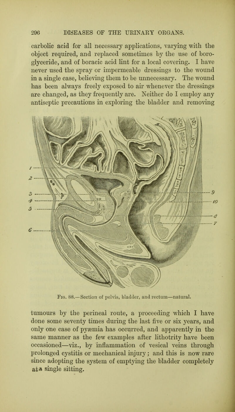 carbolic acid for all necessary applications, varying with the object required, and replaced sometimes by the use of boro- glyceride, and of boracic acid lint for a local covering. I have never used the spray or impermeable dressings to the wound in a single case, believing them to be unnecessary. The wound has been always freely exposed to air whenever the dressings are changed, as they frequently are. Neither do I employ any antiseptic precautions in exploring the bladder and removing Fig. 88.—Section of pelvis, bladder, and rectum—natural. tumours by the perineal route, a proceeding which I have done some seventy times during the last five or six years, and only one case of pyaemia has occurred, and apparently in the same manner as the few examples after lithotrity have been occasioned—viz., by inflammation of vesical veins through prolonged cystitis or mechanical injury; and this is now rare since adopting the system of emptying the bladder completely at a single sitting.