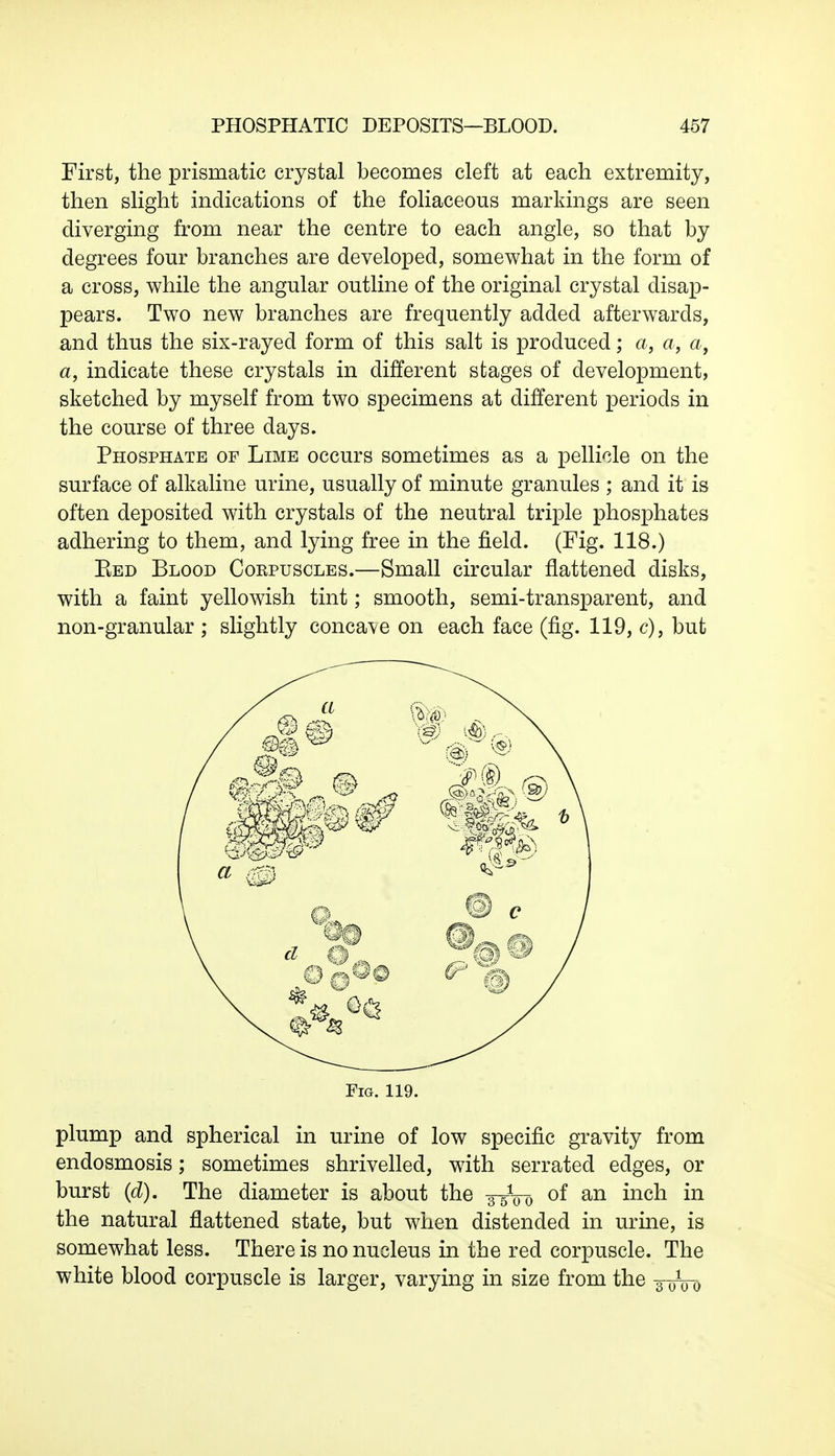 First, the prismatic crystal becomes cleft at each extremity, then slight indications of the foliaceous markings are seen diverging from near the centre to each angle, so that by degrees four branches are developed, somewhat in the form of a cross, while the angular outline of the original crystal disap- pears. Two new branches are frequently added afterwards, and thus the six-rayed form of this salt is produced; a, a, a, a, indicate these crystals in different stages of development, sketched by myself from two specimens at different periods in the course of three days. Phosphate of Lime occurs sometimes as a pellicle on the surface of alkaline urine, usually of minute granules ; and it is often deposited with crystals of the neutral triple phosphates adhering to them, and lying free in the field. (Fig. 118.) Eed Blood Coepuscles.—Small circular flattened disks, with a faint yellowish tint; smooth, semi-transparent, and non-granular ; slightly concave on each face (fig. 119, c), but plump and spherical in urine of low specific gravity from endosmosis; sometimes shrivelled, with serrated edges, or burst (d). The diameter is about the 3-5V0 °* an mcn m the natural flattened state, but when distended in urine, is somewhat less. There is no nucleus in the red corpuscle. The white blood corpuscle is larger, varying in size from the ¥0V0