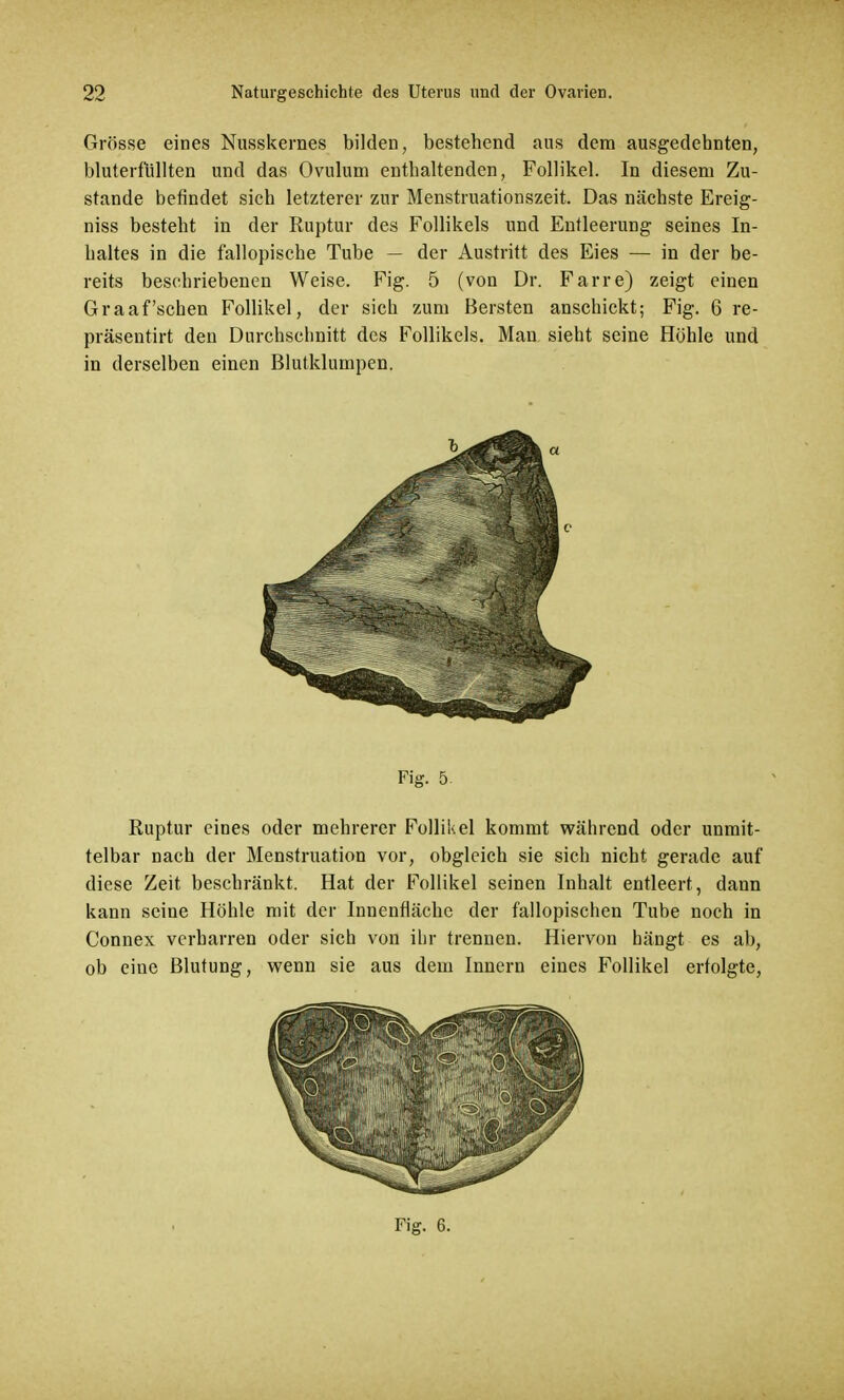 Grösse eines Nusskernes bilden, bestehend aus dem ausgedehnten, bluterfüllten und das Ovulum enthaltenden, Follikel. In diesem Zu- stande befindet sich letzterer zur Menstruationszeit. Das nächste Ereig- niss besteht in der Ruptur des Follikels und Entleerung seines In- haltes in die f'allopische Tube — der Austritt des Eies — in der be- reits beschriebenen Weise. Fig. 5 (von Dr. Farre) zeigt einen Graafschen Follikel, der sich zum Bersten anschickt; Fig. 6 re- präseutirt den Durchschnitt des Follikels. Man sieht seine Höhle und in derselben einen Blutklumpen. Fig. 5 Ruptur eines oder mehrerer Follikel kommt während oder unmit- telbar nach der Menstruation vor, obgleich sie sich nicht gerade auf diese Zeit beschränkt. Hat der Follikel seinen Inhalt entleert, dann kann seine Höhle mit der Innenfläche der fallopischen Tube noch in Connex verharren oder sich von ihr trennen. Hiervon hängt es ab, ob eine Blutung, wenn sie aus dem Innern eines Follikel erfolgte, Fig. 6.