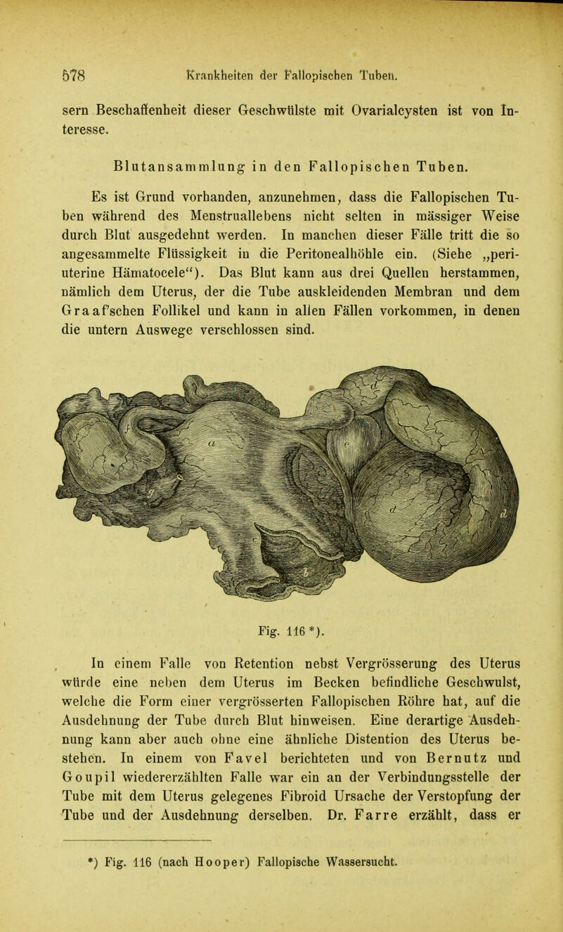 sern Beschaffenheit dieser Geschwülste mit Ovarialcysten ist von In- teresse. Blutansammlung in den Fallopischen Tuben. Es ist Grund vorhanden, anzunehmen, dass die Fallopischen Tu- ben während des Menstruallebens nicht selten in massiger Weise durch Blut ausgedehnt werden. In manchen dieser Fälle tritt die so angesammelte Flüssigkeit in die Peritonealhöhle ein. (Siehe „peri- uterine Hämatocele). Das Blut kann aus drei Quellen herstammen, nämlich dem Uterus, der die Tube auskleidenden Membran und dem Graafschen Follikel und kann in allen Fällen vorkommen, in denen die untern Auswege verschlossen sind. In einem Falle von Retention nebst Vergrösserung des Uterus würde eine neben dem Uterus im Becken befindliche Geschwulst, welche die Form einer vergrösserten Fallopischen Röhre hat, auf die Ausdehnung der Tube durch Blut hinweisen. Eine derartige Ausdeh- nung kann aber auch ohne eine ähnliche Distention des Uterus be- stehen. In einem von Favel berichteten und von B er nutz und Goupil wiedererzählten Falle war ein an der Verbindungsstelle der Tube mit dem Uterus gelegenes Fibroid Ursache der Verstopfung der Tube und der Ausdehnung derselben. Dr. Farre erzählt, dass er *) Fig. 116 (nach Hooper) Fallopische Waasersucht. Fig. 116 *).