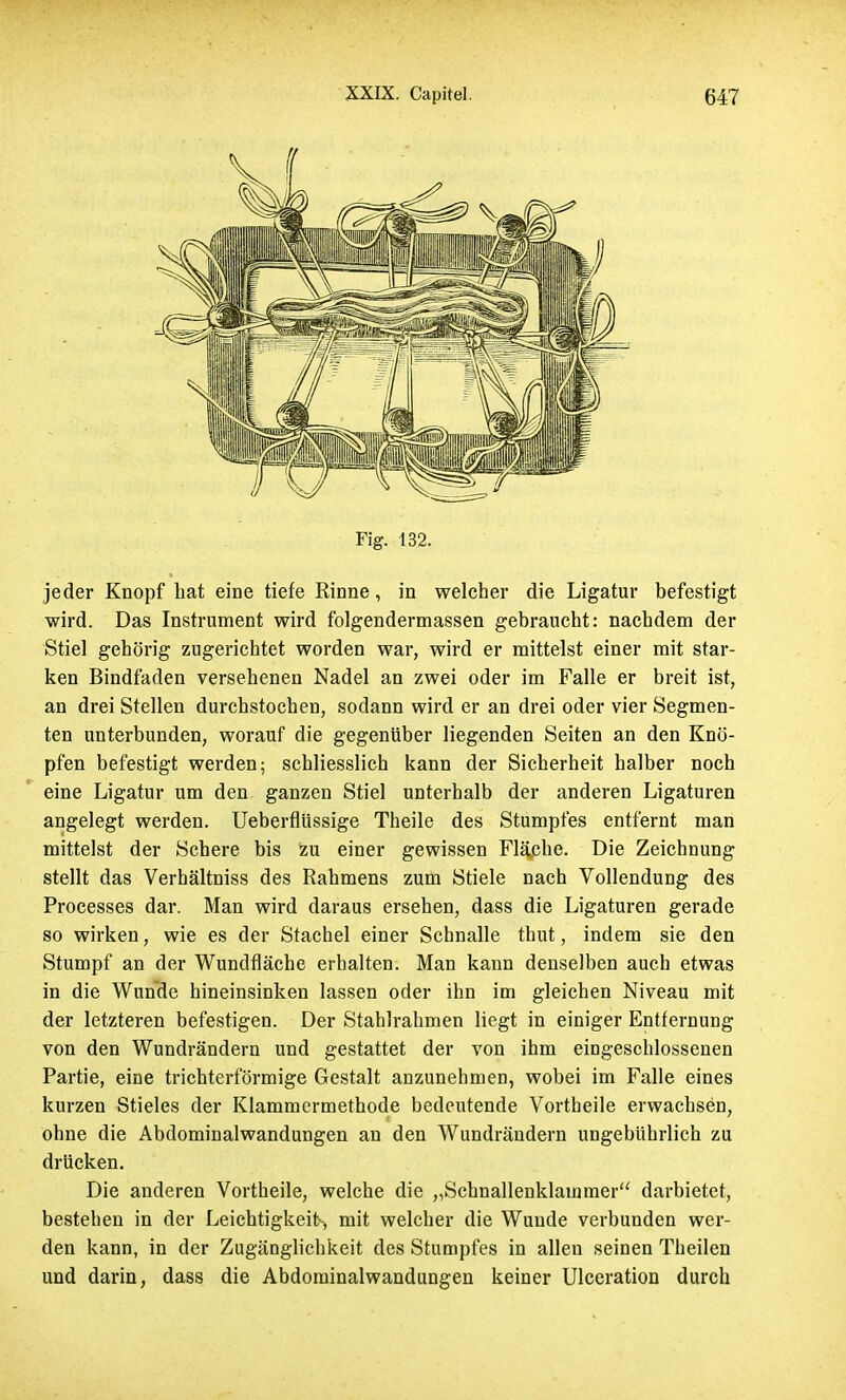 Fig. 132. jeder Knopf hat eine tiefe Rinne, in welcher die Ligatur befestigt wird. Das Instrument wird folgendermassen gebraucht: nachdem der Stiel gehörig zugerichtet worden war, wird er mittelst einer mit star- ken Bindfaden versehenen Nadel an zwei oder im Falle er breit ist, an drei Stellen durchstochen, sodann wird er an drei oder vier Segmen- ten unterbunden, worauf die gegenüber liegenden Seiten an den Knö- pfen befestigt werden; schliesslich kann der Sicherheit halber noch eine Ligatur um den ganzen Stiel unterhalb der anderen Ligaturen angelegt werden. Ueberflüssige Theile des Stumpfes entfernt man mittelst der Schere bis zu einer gewissen Fläche. Die Zeichnung stellt das Verhältniss des Rahmens zum Stiele nach Vollendung des Processes dar. Man wird daraus ersehen, dass die Ligaturen gerade so wirken, wie es der Stachel einer Schnalle thut, indem sie den Stumpf an der Wundfläche erhalten. Man kann denselben auch etwas in die Wunde hineinsinken lassen oder ihn im gleichen Niveau mit der letzteren befestigen. Der Stahlrahmen liegt in einiger Entfernung von den Wundrändern und gestattet der von ihm eingeschlossenen Partie, eine trichterförmige Gestalt anzunehmen, wobei im Falle eines kurzen Stieles der Klammermethode bedeutende Vortheile erwachsen, ohne die Abdominalwandungen an den Wundrändern ungebührlich zu drücken. Die anderen Vortheile, welche die „Schnallenklammer darbietet, bestehen in der Leichtigkeit-, mit welcher die Wunde verbunden wer- den kann, in der Zugänglichkeit des Stumpfes in allen seinen Theilen und darin, dass die Abdorainalwandungen keiner Ulceration durch