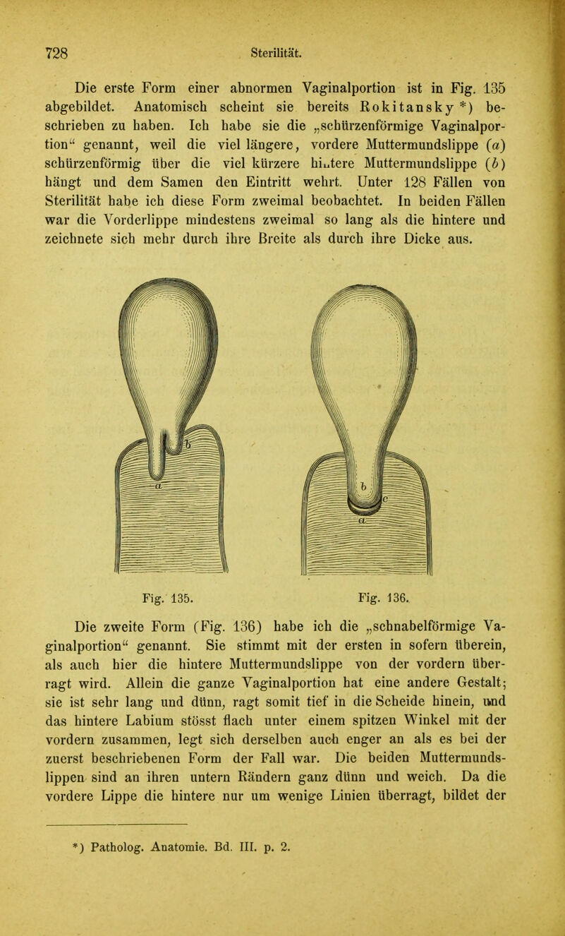 Die erste Form einer abnormen Vaginalportion ist in Fig. 135 abgebildet. Anatomisch scheint sie bereits Kokitansky *) be- schrieben zu haben. Ich habe sie die „schürzenförmige Vaginalpor- tionu genannt, weil die viel längere, vordere Muttermundslippe (a) schürzenförmig über die viel kürzere hiutere Muttermundslippe (£) hängt und dem Samen den Eintritt wehrt. Unter 128 Fällen von Sterilität habe ich diese Form zweimal beobachtet. In beiden Fällen war die Vorderlippe mindestens zweimal so lang als die hintere und zeichnete sich mehr durch ihre Breite als durch ihre Dicke aus. Fig. 135. Fig. 136. Die zweite Form (Fig. 136) habe ich die „schnabelförmige Va- ginalportion genannt. Sie stimmt mit der ersten in sofern Uberein, als auch hier die hintere Muttermundslippe von der vordem über- ragt wird. Allein die ganze Vaginalportion hat eine andere Gestalt; sie ist sehr lang und dünn, ragt somit tief in die Scheide hinein, und das hintere Labium stösst flach unter einem spitzen Winkel mit der vordem zusammen, legt sich derselben auch enger an als es bei der zuerst beschriebenen Form der Fall war. Die beiden Muttermunds- lippen sind an ihren untern Rändern ganz dünn und weich. Da die vordere Lippe die hintere nur um wenige Linien überragt, bildet der *) Patholog. Anatomie. Bd. III. p. 2.