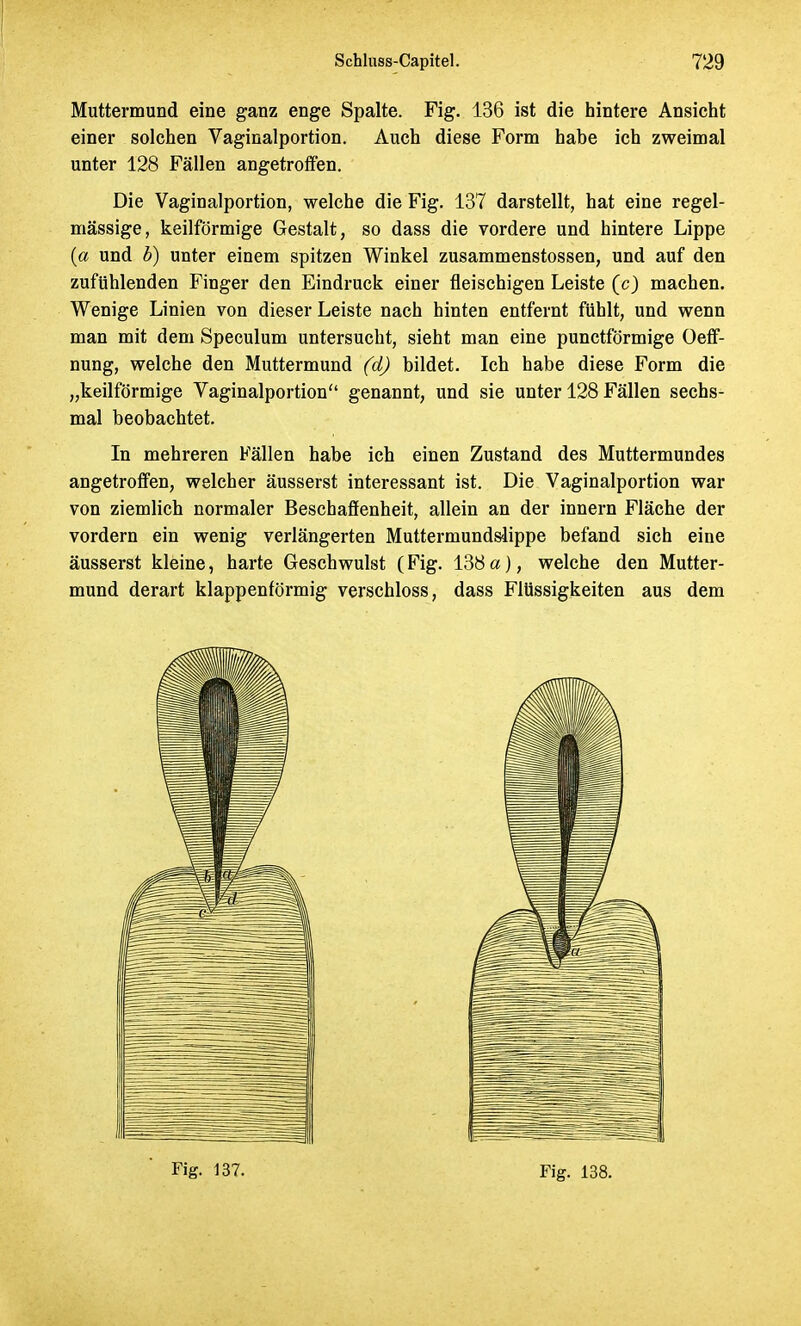 Muttermund eine ganz enge Spalte. Fig. 136 ist die hintere Ansicht einer solchen Vaginalportion. Auch diese Form habe ich zweimal unter 128 Fällen angetroffen. Die Vaginalportion, welche die Fig. 137 darstellt, hat eine regel- mässige, keilförmige Gestalt, so dass die vordere und hintere Lippe (a und b) unter einem spitzen Winkel zusammenstossen, und auf den zufühlenden Finger den Eindruck einer fleischigen Leiste (c) machen. Wenige Linien von dieser Leiste nach hinten entfernt fühlt, und wenn man mit dem Speculum untersucht, sieht man eine punctförmige Oeff- nung, welche den Muttermund (d) bildet. Ich habe diese Form die „keilförmige Vaginalportion genannt, und sie unter 128 Fällen sechs- mal beobachtet. In mehreren Fällen habe ich einen Zustand des Muttermundes angetroffen, welcher äusserst interessant ist. Die Vaginalportion war von ziemlich normaler Beschaffenheit, allein an der innern Fläche der vordem ein wenig verlängerten Muttermundslippe befand sich eine äusserst kleine, harte Geschwulst (Fig. 138a), welche den Mutter- mund derart klappenförmig verschloss, dass Flüssigkeiten aus dem