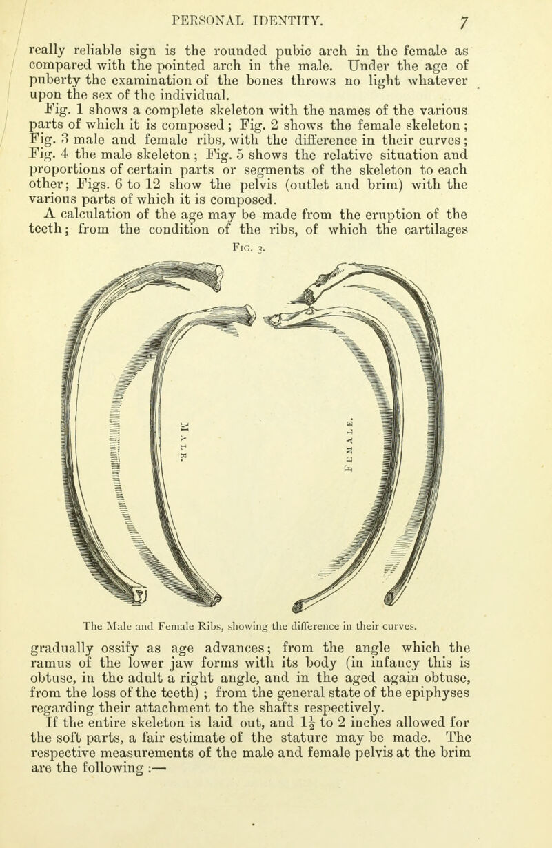 really reliable sign is the rounded pubic arch in the female as compared with the pointed arch in the male. Under the age of puberty the examination of the bones throws no light whatever upon the sex of the individual. Fig. 1 shows a complete skeleton with the names of the various parts of which it is composed; Fig. 2 shows the female skeleton ; Fig. 3 male and female ribs, with the difference in their curves; Fig. 4 the male skeleton ; Fig. 5 shows the relative situation and proportions of certain parts or segments of the skeleton to each other; Figs. 6 to 12 show the pelvis (outlet and brim) with the various parts of which it is composed. A calculation of the age may be made from the eruption of the teeth; from the condition of the ribs, of which the cartilages Fig. 3. The Male and Female Ribs, showing the difference in their curves. gradually ossify as age advances; from the angle which the ramus of the lower jaw forms with its body (in infancy this is obtuse, in the adult a right angle, and in the aged again obtuse, from the loss of the teeth) ; from the general state of the epiphyses regarding their attachment to the shafts respectively. If the entire skeleton is laid out, and 1^ to 2 inches allowed for the soft parts, a fair estimate of the stature may be made. The respective measurements of the male and female pelvis at the brim are the following :—