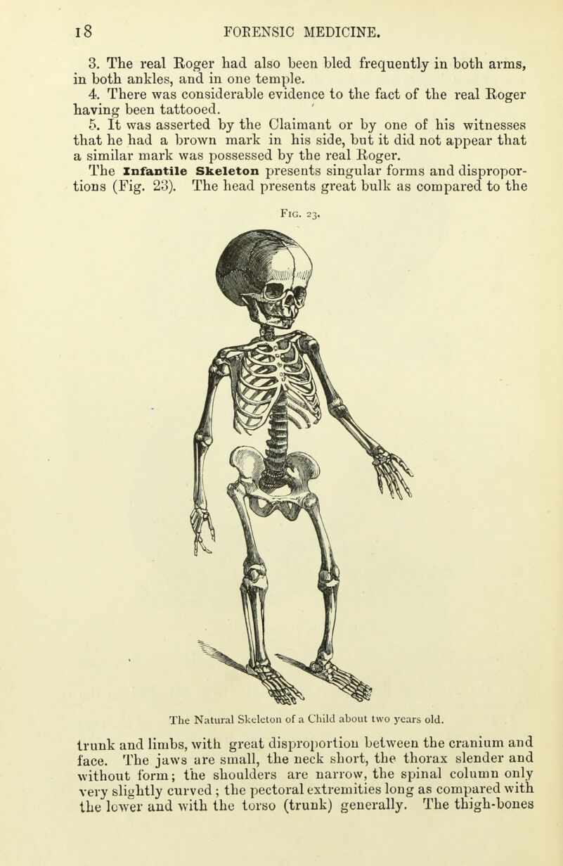 3. The real Roger had also been bled frequently in both arms, in both ankles, and in one temple. 4. There was considerable evidence to the fact of the real Roger having been tattooed. 5. It was asserted by the Claimant or by one of his witnesses that he had a brown mark in his side, but it did not appear that a similar mark was possessed by the real Roger. The Infantile Skeleton presents singular forms and dispropor- tions (Fig. 23). The head presents great bulk as compared to the Fig. 23. The Natural Skeleton of a Child about two years old. trunk and limbs, with great disproportion between the cranium and face. The jaws are small, the neck short, the thorax slender and without form; the shoulders are narrow, the spinal column only very slightly curved ; the pectoral extremities long as compared with the lower and with the torso (trunk) generally. The thigh-bones