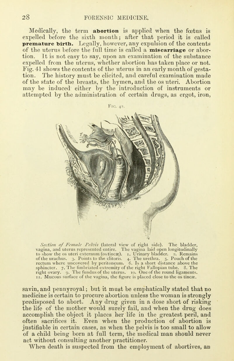 Medically, the term abortion is applied when the foetus is expelled before the sixth month; after that period it is called premature birth. Legally, however, any expulsion of the contents of the uterus before the full time is called a miscarriage or abor- tion. It is not easy to say, upon an examination of the substance expelled from the uterus, whether abortion has taken place or not. Fig. 41 shows the contents of the uterus in an early month of gesta- tion. The history must be elicited, and careful examination made of the state of the breasts, the hymen, and the os uteri. Abortion may be induced either by the introduction of instruments or attempted by the administration of certain drugs, as ergot, iron, Fig. 42. Section of Female Pelvis (lateral view of right side). The bladder, vagina, and uterus represented entire. The vagina laid open longitudinally to show the os uteri externum (ostincse). 1. Urinary bladder. 2. Remains of the urachus. 3. Points to the clitoris. 4. The urethra. 5. Pouch of the rectum where uncovered by peritoneum. 6. Is a short distance above the sphincter. 7. The fimbriated extremity of the right Fallopian tube. 8. The right ovary. 9. The fundus of the uterus. 10. One of the round ligaments. 11. Mucous surface of the vagina, the figure is placed close to the os tincse. savin, and pennyroyal; but it mast be emphatically stated that no medicine is certain to procure abortion unless the woman is strongly predisposed to abort. Any drug given in a dose short of risking the life of the mother would surely fail, and when the drug does accomplish the object it places her life in the greatest peril, and often sacrifices it. Even when the production of abortion is justifiable in certain cases, as when the pelvis is too small to allow of a child being born at full term, the medical man should never act without consulting another practitioner. When death is suspected from the employment of abortives, an