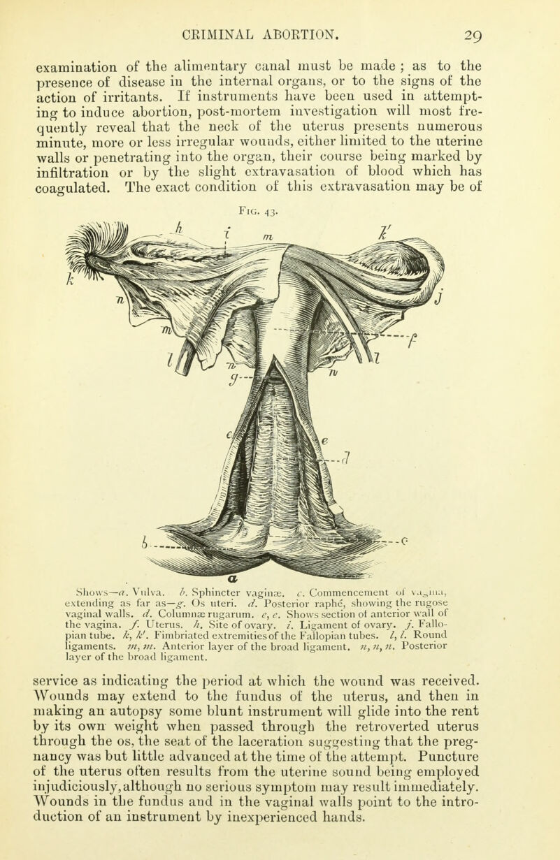 examination of the alimentary canal must be made ; as to the presence of disease in the internal organs, or to the signs of the action of irritants. If instruments have been used in attempt- ing to induce abortion, post-mortem investigation will most fre- quently reveal that the neck of the uterus presents numerous minute, more or less irregular wounds, either limited to the uterine walls or penetrating into the organ, their course being marked by infiltration or by the slight extravasation of blood which has coagulated. The exact condition of this extravasation may be of Fig. 43. Shows—a. Vulva. /'. Sphincter vagina;, c. Commencement ul vagina, extending as far as— Os uteri, d. Posterior raphe, showing the rugose vaginal walls, d. Columnar rugarnm. c, e. Shows section of anterior wall of the vagina, f. Uterus, h. Site of ovary, i. Ligament of ovary, j. Fallo- pian tube, k, k'. Fimbriated extremities of the Fallopian tubes. /,/. Round ligaments, m, m. Anterior layer of the broad ligament. 11,71,11. Posterior layer of the broad ligament. service as indicating the period at which the wound was received. Wounds may extend to the fundus of the uterus, and then in making an autopsy some blunt instrument will glide into the rent by its own weight when passed through the retroverted uterus through the os, the seat of the laceration suggesting that the preg- nancy was but little advanced at the time of the attempt. Puncture of the uterus often results from the uterine sound being employed injudiciously,although no serious symptom may result immediately. Wounds in the fundus aud in the vaginal walls point to the intro- duction of an instrument by inexperienced hands.