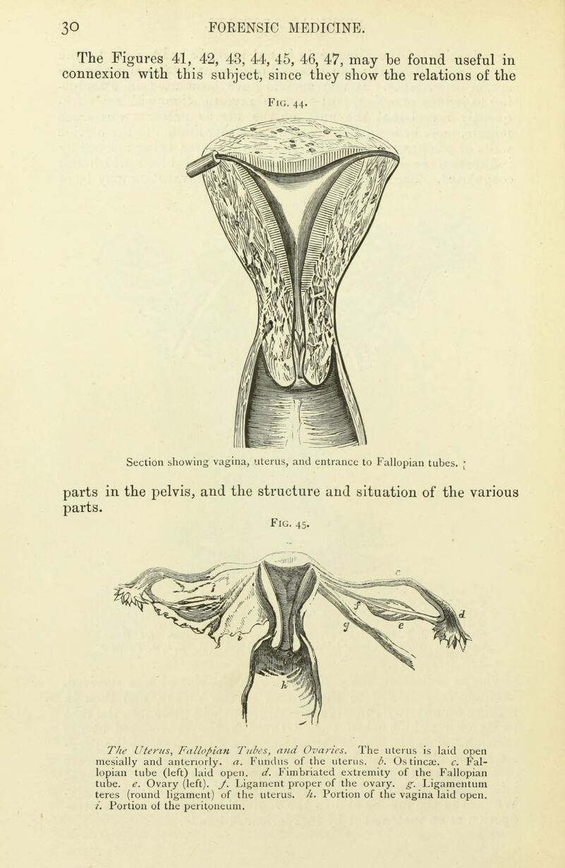 The Figures 41, 42, 43, 44, 45, 46, 47, may be found useful in connexion with this subject, since they show the relations of the Fig. 44. The Uterus, Fallopian Tubes, and Ovaries. The uterus is laid open mesially and anteriorly, a. Fundus of the uterus, b. Os tincse. c. Fal- lopian tube (left) laid open. d. Fimbriated extremity of the Fallopian tube. e. Ovary (left). J. Ligament proper of the ovary, g. Ligamentum teres (round ligament) of the uterus, h. Portion of the vagina laid open. i. Portion of the peritoneum.