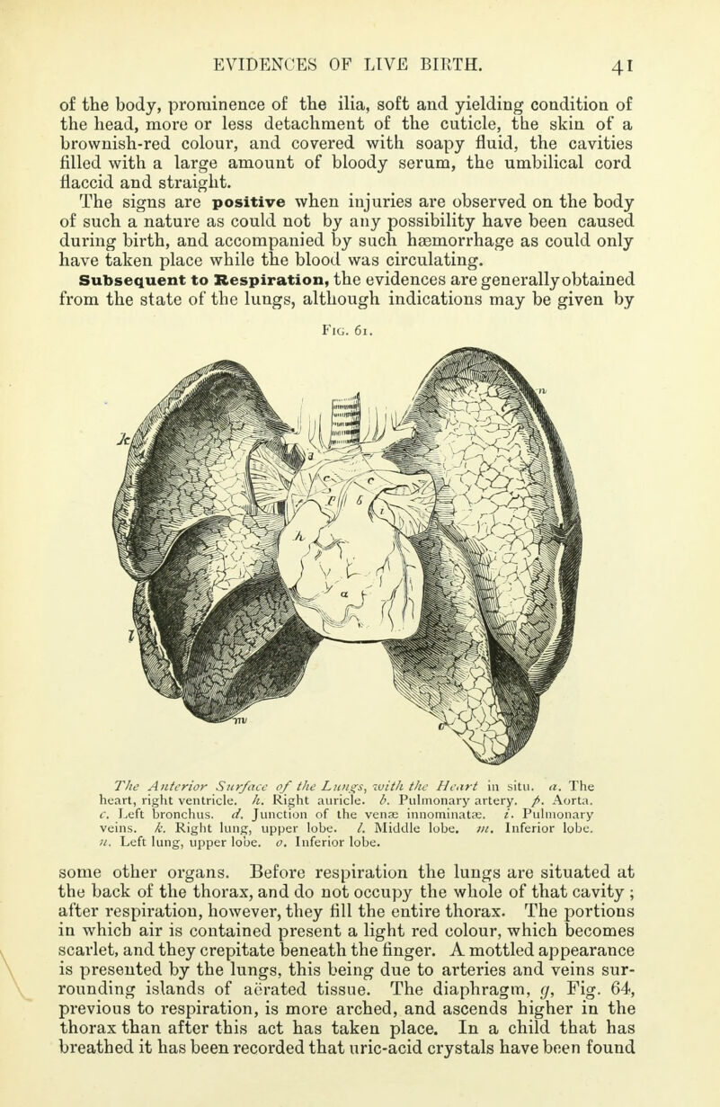 of the body, prominence of the ilia, soft and yielding condition of the head, more or less detachment of the cuticle, the skin of a brownish-red colour, and covered with soapy fluid, the cavities filled with a large amount of bloody serum, the umbilical cord flaccid and straight. The signs are positive when injuries are observed on the body of such a nature as could not by any possibility have been caused during birth, and accompanied by such haemorrhage as could only have taken place while the blood was circulating. Subsequent to Respiration, the evidences are generally obtained from the state of the lungs, although indications may be given by Fig. 61. The Anterior Surface ofthe Lungs; with the Heart in situ. a. The heart, right ventricle, h. Right auricle, b. Pulmonary artery. Aorta. C Left bronchus, d. Junction of the venae innominatae. i. Pulmonary veins, k. Right lung, upper lobe. /. Middle lobe. m. Inferior lobe. n. Left lung, upper lobe. o. Inferior lobe. some other organs. Before respiration the lungs are situated at the back of the thorax, and do not occupy the whole of that cavity ; after respiration, however, they fill the entire thorax. The portions in which air is contained present a light red colour, which becomes scarlet, and they crepitate beneath the finger. A mottled appearance is presented by the lungs, this being due to arteries and veins sur- rounding islands of aerated tissue. The diaphragm, g, Fig. 64, previous to respiration, is more arched, and ascends higher in the thorax than after this act has taken place. In a child that has breathed it has been recorded that uric-acid crystals have been found