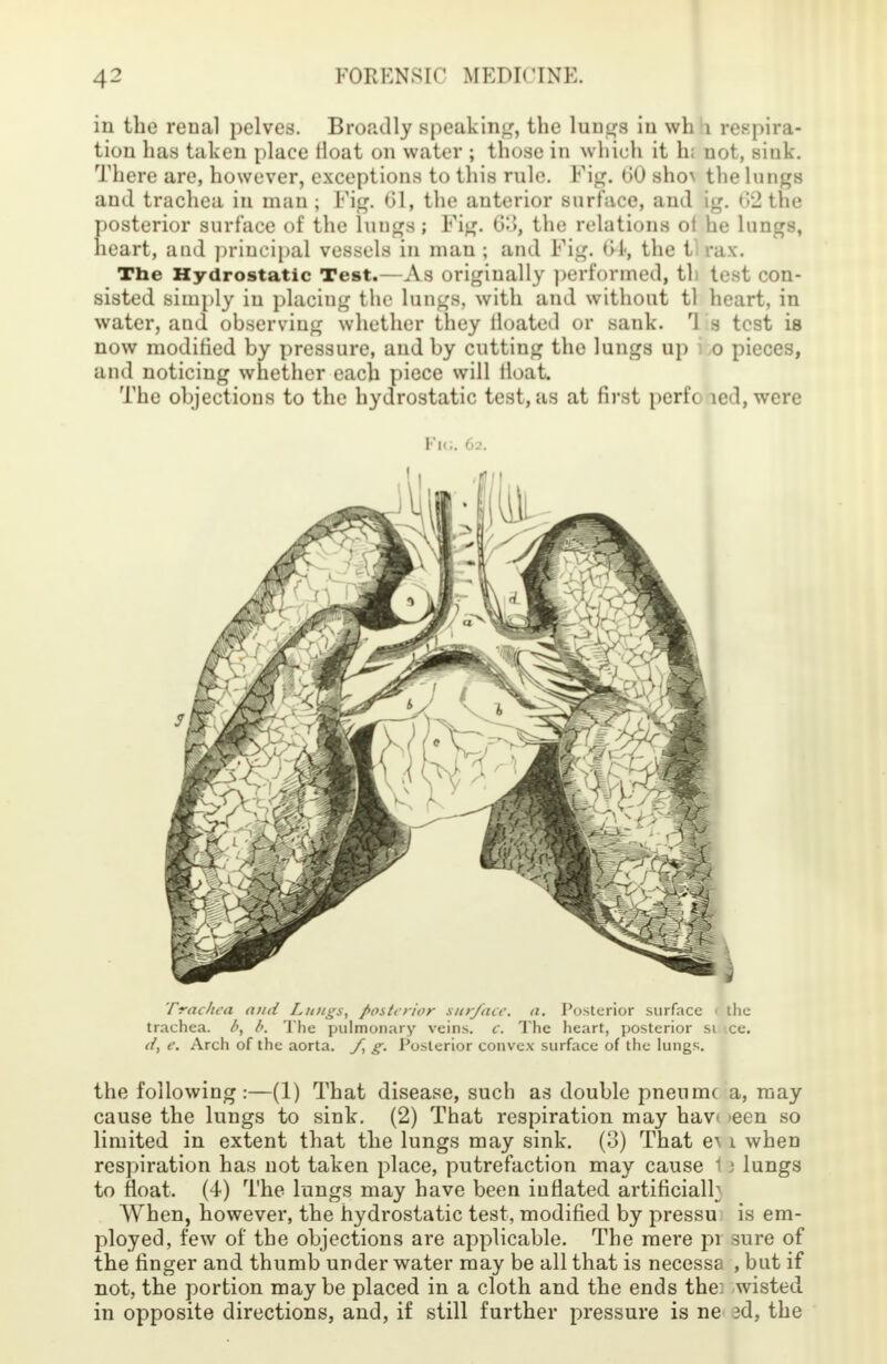 in the renal pelves. Broadly Bpeaking, the lungs iu wh 1 respira- tion has taken place float on water ; those in which it hi not, sink. There are, however, exceptions to this rule. Fig. tiU sl^ the lungs and trachea in man ; Fig. 61, the anterior surface, anil ig. t',J the posterior surface of the lungs; Fig. G3, the relations of he lungs, heart, and principal vessels in man ; and Fig. (>1<, the tl rax. The Hydrostatic Test.—As originally performed, th test con- sisted simply iu placing the lungs, with and without tl heart, in water, and observing whether they lloated or sank. rJ s test is now modified by pressure, and by cutting the lungs up o pieces, and noticing whether each piece will float. The objections to the hydrostatic test, as at first perfo led, were Fig. 6.'. Trtic/ica ami Lungs, posterior surface, a. Posterior surface i the trachea, d, b. The pulmonary veins, c. The heart, posterior si ce. dt e. Arch of the aorta. /, g. Posterior convex surface of the lungs. the following:—(1) That disease, such as double pneunu a, may cause the lungs to sink. (2) That respiration may hav< een so limited in extent that the lungs may sink. (3) That ey i when respiration has not taken place, putrefaction may cause 1 5 lungs to float. (4) The lungs may have been inflated artificiall When, however, the hydrostatic test, modified by pressu is em- ployed, few of the objections are applicable. The mere pi sure of the finger and thumb under water may be all that is necessa , but if not, the portion may be placed in a cloth and the ends the: wisted in opposite directions, and, if still further pressure is ne ad, the