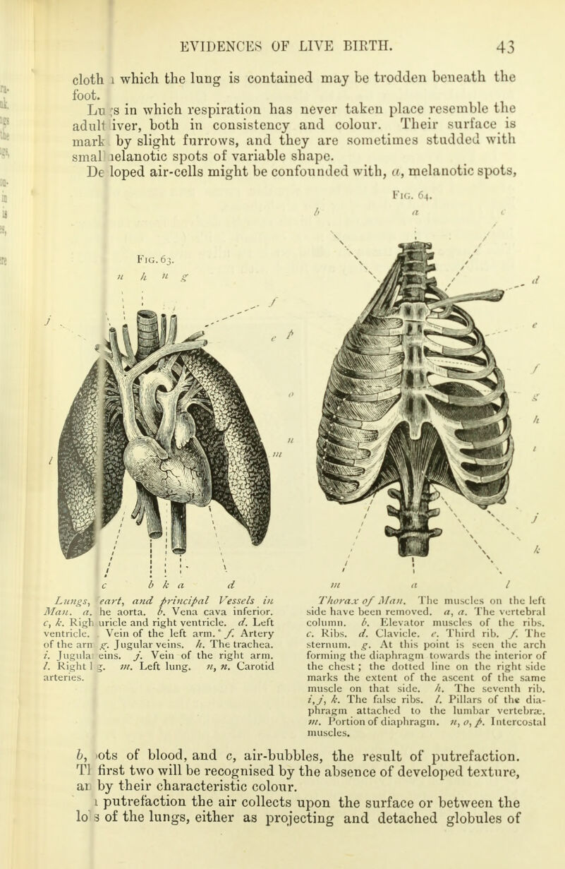 cloth i which the lung is contained may be trodden beneath the foot. Jjv ;s in which respiration has never taken place resemble the adult iver, both in consistency and colour. Their surface is mark by slight furrows, and they are sometimes studded with smal lelanotic spots of variable shape. De loped air-cells might be confounded with, a, melanotic spots, Fig. 64. b a b k Lungs, eart, and principal Vessels in Man. a. he aorta, b. Vena cava inferior. c, k. Righ uricle and right ventricle, d. Left ventricle. Vein of the left arm.' f. Artery of the arn g\ Jugular veins, h. The trachea. i. Jugula eins. /. Vein of the right arm. /. Right 1 1. m. Left lung. n. Carotid arteries. Thorax 0/ Man. The muscles on the left side have been removed, a, a. The vertebral column. b. Elevator muscles of the ribs. c. Ribs. d. Clavicle, e. Third rib. / The sternum, g. At this point is seen the arch forming the diaphragm towards the interior of the chest; the dotted line on the right side marks the extent of the ascent of the same muscle on that side. //. The seventh rib. t,Jt k. The false ribs. /. Pillars of the dia- phragm attached to the lumbar vertebra;. m. Portion of diaphragm, n, o, p. Intercostal muscles. b, >ots of blood, and c, air-bubbles, the result of putrefaction. Tl first two will be recognised by the absence of developed texture, ar by their characteristic colour. 1 putrefaction the air collects upon the surface or between the lo 3 of the lungs, either as projecting and detached globules of
