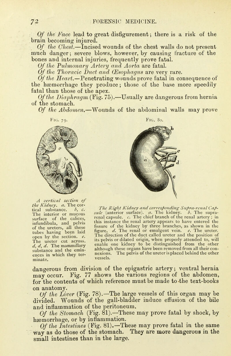 Of the Face lead to great disfigurement; there is a risk of the brain becoming injured. Of the Chest.—Incised wounds of the chest walls do not present much danger; severe blows, however, by causing fracture of the bones and internal injuries, frequently prove fatal. Of the Pulmonary Artery and Aorta are fatal. Of the Thoracic Duct and (Esophagus are very rare. Of the Heart.—Penetrating wounds prove fatal in consequence of the ha)morrhage they produce ; those of the base more speedily fatal than those of the apex. Of the Diaphragm (Fig. 75).—Usually are dangerous from hernia of the stomach. Of the Abdomen.—Wounds of the abdominal walls may prove Fig. 80. A vertical section of the Kidney, a. The cor- tical substance. b, c. The interior or mucous surface of the calices, infundibula, and pelvis of the ureters, all these tubes having been laid open by the section, e. The ureter cut across. d, d, d. The mammillary substance and the emin- ences in which they ter- minate. The Right Kidney and corresponding Supra-renal Cap- sule (anterior surface), a. The kidney. b. The supra- renal capsule, c. The chief branch of the renal artery ; in this instance the renal artery appears to have entered the fissure of the kidney by three branches, as shown in the figure, d. The renal or emulgent vein. e. The ureter. The direction of the duct called ureter and the position of its pelvis or dilated origin, when properly attended to, will enable one kidney to be distinguished from the other although these organs have been removed from all their con- nexions. The pelvis of the ureter is placed behind the other vessels. dangerous from division of the epigastric artery; ventral hernia may occur. Fig. 77 shows the various regions of the abdomen, for the contents of which reference must be made to-the text-books on anatomy. Of the Liver (Fig. 78).—The large vessels of this organ may be divided. Wounds of the gall-bladder induce effusion of the bile and inflammation of the peritoneum. Of the Stomach (Fig. 81).—These may prove fatal by shock, by hemorrhage, or by inflammation. Of the Intestines (Fig. 81).—These may prove fatal in the same way as do those of the stomach. They are more dangerous in the small intestines than in the large.