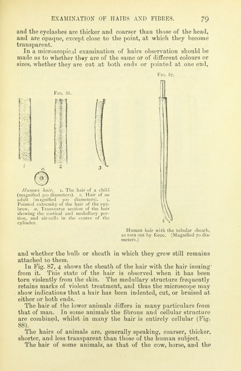 and the eyelashes are thicker and coarser than those of the head, and are opaque, except close to the point, at which they become transparent. In a microscopical examination of hairs observation should be made as to whether they are of the same or of different colours or sizes, whether they are cut at both ends or pointed at one end, Fig. 87. i Fig. m ^1 Z Human hair. 1. The hair of a child (magnified 300 diameters). 2. Hair of an adult (magnified 300 diameters). 3. Pointed extremity of the hair of the eye- brow, a. Transverse section of the hair showing the cortical and medullary por- tion, and air-cells in the centre of the cylinder. 4 Human hair with the tubular sheath, as torn out by force. (Magnified 70 dia- meters.) and whether the bulb or sheath in which they grew still remains attached to them. In Fig. 87, 4 shows the sheath of the hair with the hair issuing from it. This state of the hair is observed when it has been torn violently from the skin. The medullary structure frequently retains marks of violent treatment, and thus the microscope may show indications that a hair has been indented, cut, or bruised at either or both ends. The hair of the lower animals differs in many particulars from that of man. In some animals the fibrous and cellular structure are combined, whilst in many the hair is entirely cellular (Fig. 88). The hairs of animals are, generally speaking, coarser, thicker, shorter, and less transparent than those of the human subject. The hair of some animals, as that of the cow, horse, and the