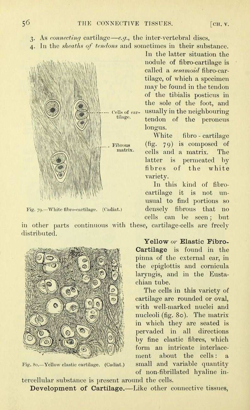 Cells of car- tilage. Fibrous matrix. 3. As connecting cartilage—e.g.^ the inter-vertebral discs. 4. In the sheaths of tendons and sometimes in their substance. In the latter situation the nodule of fibro-cartilage is called a sesamoid fibro-car- tilage, of which a specimen may be found in the tendon of the tibialis posticus in the sole of the foot, and usually in the neighbouring tendon of the peroneus longus. White fibro - cartilage (fig. 79) is composed of cells and a matrix. The latter is permeated by fibres of the white variety. In this kind of fibro- cartilage it is not un- usual to find portions so densely fibrous that no cells can be seen; but in other parts continuous Avitli these, cartilage-cells are freely distributed. Yellow or Elastic Fibro- Cartilage is found in the pinna of the external ear, in the epiglottis and cornicula laryngis, and in the Eusta- chian tube. The cells in this variety of cartilage are rounded or oval, with well-marked nuclei and nucleoli (fig. 80). The matrix in which they are seated is pervaded in all directions by fine elastic fibres, which form an intricate interlace- ment about the cells: a small and variable quantity of non-fibrillated hyaline in- tercellular substance is present aroimd the cells. Development of Cartilage.—Like other connective tissues, Fig. 79.—White fibro-cartilage. (Cadiat.) Fig-. 80.—Yellow elastic cartilage. (Cadiat.)