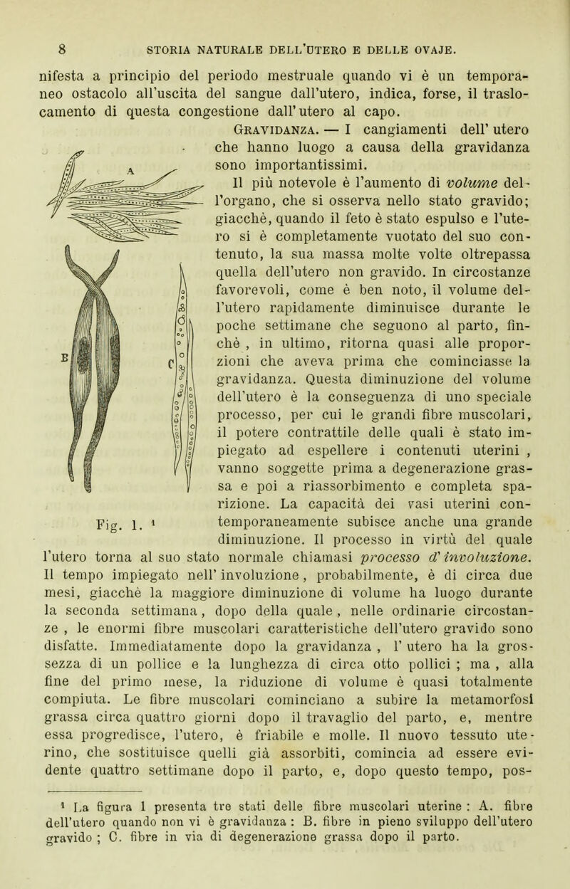 nifesta a principio del periodo mestruale quando vi è un tempora- neo ostacolo all'uscita del sangue dall'utero, indica, forse, il traslo- camento di questa congestione dall'utero al capo. Gravidanza. — I cangiamenti dell' utero che hanno luogo a causa della gravidanza sono importantissimi. 11 più notevole è l'aumento di volume del- l'organo, che sì osserva nello stato gravido; giacché, quando il feto è stato espulso e l'ute- ro si è completamente vuotato del suo con- tenuto, la sua massa molte volte oltrepassa quella dell'utero non gravido. In circostanze favorevoli, come è ben noto, il volume del- l'utero rapidamente diminuisce durante le poche settimane che seguono al parto, fin- ché , in ultimo, ritorna quasi alle propor- zioni che aveva prima che cominciasse la gravidanza. Questa diminuzione del volume dell'utero è la conseguenza di uno speciale processo, per cui le grandi fibre muscolari, il potere contrattile delle quali è stato im- piegato ad espellere i contenuti uterini , vanno soggette prima a degenerazione gras- sa e poi a riassorbimento e completa spa- rizione. La capacità dei vasi uterini con- temporaneamente subisce anche una grande diminuzione. Il processo in virtù del quale l'utero torna al suo stato normale chiamasi processo d'involuzione. Il tempo impiegato nell' involuzione , probabilmente, è di circa due mesi, giacché la maggiore diminuzione di volume ha luogo durante la seconda settimana, dopo della quale , nelle ordinarie circostan- ze , le enormi fibre muscolari caratteristiche dell'utero gravido sono disfatte. Immediatamente dopo la gravidanza , 1' utero ha la gros- sezza di un pollice e la lunghezza di circa otto pollici ; ma , alla fine del primo mese, la riduzione di volume è quasi totalmente compiuta. Le fibre muscolari cominciano a subire la metamorfosi grassa circa quattro giorni dopo il travaglio del parto, e, mentre essa progredisce, l'utero, é friabile e molle. Il nuovo tessuto ute- rino, che sostituisce quelli già assoi^biti, comincia ad essere evi- dente quattro settimane dopo il parto, e, dopo questo tempo, pos- Fig. 1. » ' La figura 1 presenta ti'o stati delle fibre muscolari uterine : A. fibre dell'utero quando non vi è gravidanza : B. fibre in pieno sviluppo dell'utero CTravido ; C. fibre in via di degenerazione grassa dopo il parto.