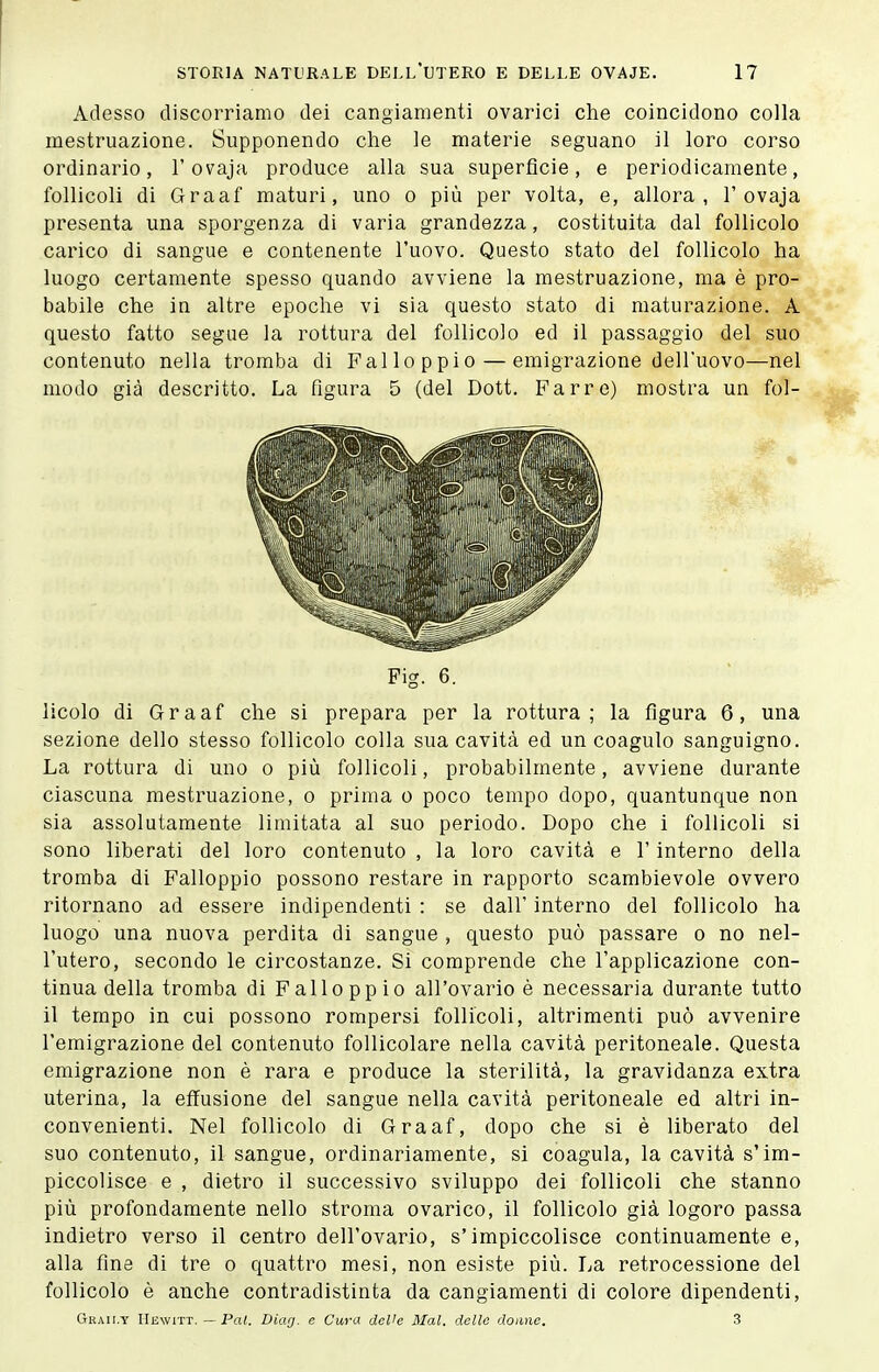 Adesso discorriamo dei cangiamenti ovarici che coincidono colla mestruazione. Supponendo che le materie seguano il loro corso ordinario, l'ovaja produce alla sua superficie, e periodicamente, follicoli di Graaf maturi, uno o più per volta, e, allora, 1'ovaja presenta una sporgenza di varia grandezza, costituita dal follicolo carico di sangue e contenente l'uovo. Questo stato del follicolo ha luogo certamente spesso quando avviene la mestruazione, ma è pro- babile che in altre epoche vi sia questo stato di maturazione. A questo fatto segue la rottura del follicolo ed il passaggio del suo contenuto nella tromba di Fai loppio — emigrazione dell'uovo—nel modo già descritto. La figura 5 (del Dott. Far re) mostra un fol- Pig. 6. licolo di Graaf che si prepara per la rottura; la figura 6, una sezione dello stesso follicolo colla sua cavità ed un coagulo sanguigno. La rottura di uno o più follicoli, probabilmente, avviene durante ciascuna mestruazione, o prima o poco tempo dopo, quantunque non sia assolutamente limitata al suo periodo. Dopo che i follicoli si sono liberati del loro contenuto , la loro cavità e l'interno della tromba di Falloppio possono restare in rapporto scambievole ovvero ritornano ad essere indipendenti : se dall' interno del follicolo ha luogo una nuova perdita di sangue , questo può passare o no nel- l'utero, secondo le circostanze. Si comprende che l'applicazione con- tinua della tromba di Falloppio all'ovario è necessaria durante tutto il tempo in cui possono rompersi follicoli, altrimenti può avvenire l'emigrazione del contenuto follicolare nella cavità peritoneale. Questa emigrazione non è rara e produce la sterilità, la gravidanza extra uterina, la effusione del sangue nella cavità peritoneale ed altri in- convenienti. Nel follicolo di Graaf, dopo che si è liberato del suo contenuto, il sangue, ordinariamente, si coagula, la cavità s'im- piccolisce e , dietro il successivo sviluppo dei follicoli che stanno più profondamente nello stroma ovarico, il follicolo già logoro passa indietro verso il centro dell'ovario, s'impiccolisce continuamente e, alla fine di tre o quattro mesi, non esiste più. La retrocessione del follicolo è anche contradistinta da cangiamenti di colore dipendenti, Ctrau.y IIewitt. — Pa/. Diag. e Cura delle Mal. delle donne. 3