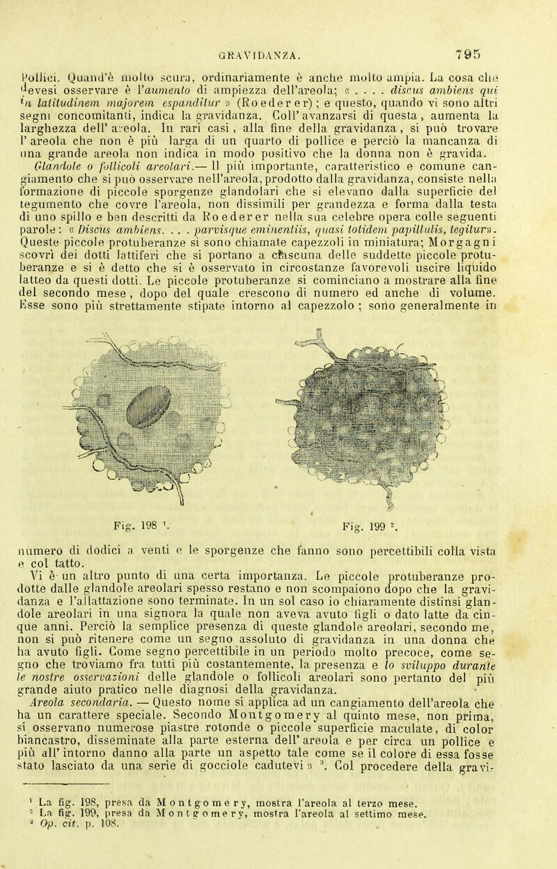 Pollici. Quaiid'ò molto scura, ordinariamente è anche molto ampia. La cosa che ';'evesi osservare è Vaiimenlo dì ampiezza dell'areola; k . . . . discus ambiens qui hi laiitudinem majorem espaiidilur n (Roeder er) ; e questo, quando vi sono alti'i segni concomitanti, indica la gravidanza. Coli'avanzarsi di questa, aumenta la larghezza dell'areola. In rari casi, alla fine della gravidanza, si può trovare r areola che non è più larga di un quarto di pollice e perciò la mancanza di una grande areola non indica in modo positivo che la donna non è gravida. Glandole o follicoli areolari.— 11 più importante, caratteristico e comune can- giamento che si può osservare nell'areola, prodotto dalla gravidanza, consiste nelln formazione di piccole sporgenze glandolari che si elevano dalla superficie del tegumento che covre l'areoia, non dissimili per grandezza e forma dalla testa di uno spillo e ben descritti da Roederer nella sua celebre opera colle seguenti parole: « Discus ambiens. . . . parvisque emiiienliis, quasi tolidem papillulis, legiturn. Queste piccole protuberanze si sono chiamate capezzoli in miniatura; Morgagni scovri dei dotti lattiferi che si portano a cftiscuna delle suddette piccole protu- beranze e si è detto che si è osservato in circostanze favorevoli uscire liquido latteo da questi dotti. Le piccole protuberanze si cominciano a mostrare alla fine del secondo mese, dopo del quale crescono di numero ed anche di volume. Ksse sono più strettamente stipate intorno al capezzolo ; sono generalmente in Fig. 198 \ Fig. 199 =. numero di dodici a venti e le sporgenze che fanno sono percettibili colla vista e col tatto. Vi è- un altro punto di una certa importanza. Le piccole protubei-anze pro- dotte dalle glandole areolari spesso restano e non scompaiono dopo che la gravi- danza e l'allattazione sono terminate. In un sol caso io chiaramente distinsi glan- dole areolari in una signora la quale non aveva avuto figli o dato latte da cin- que anni. Perciò la semplice presenza di queste glandole areolari, secondo me, non si può ritenere come un segno assoluto di gravidanza in una donna che ha avuto figli. Come segno percettibile in un periodo molto precoce, come se- gno che ti'oviamo fra tutti più costantemente, la presenza e lo sviluppo durante le nosire osservazioni delle glandole o follicoli areolari sono pertanto del più grande aiuto pratico nelle diagnosi della gravidanza. Areola secondaria. — Questo nome si applica ad un cangiamento dell'areola che ha un carattere speciale. Secondo Montgomery al quinto mese, non prima, si osservano numerose piastre rotonde o piccole superficie maculate, di color biancastro, disseminate alla parte esterna dell'areola e per circa un pollice e più all'intorno danno alla parte un aspetto tale come se il colore di essa fosse stato lasciato da una serie di gocciole cadutevi n ■'. Gol procedere della gravir ' La fig. 198, presa da Montgomery, mostra l'areoia al terzo mese. - La fig. 199, presa da Monts'omerv, mostra l'areoia ai settimo mese. » Op. cit. p. lOS.