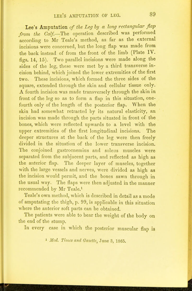 lee's amputation of leg. lee's Amputation of the Leg hj a long rectangular flap from the Calf—The. operation described was performed according to Mr Teale's method, as far as the external incisions were concerned, but the long flap was made from the back instead of from the front of the limb (Plate IV. figs. 14, 15). Two parallel incisions were made along the sides of the leg, these were met by a third transverse in- cision behind, which joined the lower extremities of the first two. These incisions, which formed the three sides of the square, extended through the skin and cellular tissue only. A fourth incision was made transversely through the skin in front of the leg so as to form a flap in this situation, one- fourth only of the length of the posterior flap. When the skin had somewhat retracted by its natural elasticity, an incision was made through the parts situated in front of the bones, which were reflected upwards to a level with the upper extremities of the first longitudinal incisions. The deeper structures at the back of the leg were then freely divided in the situation of the lower transverse incision. The conjoined gastrocnemius and soleus muscles were separated from the subjacent parts, and reflected as high as the anterior flap. The deeper layer of muscles, together with the large vessels and nerves, wer6 divided as high as the incision would permit, and the bones sawn through in the usual way. The flaps were then adjusted in the manner recommended by Mr Teale,^ Teale's own method, which is described in detail as a mode of amputating the thigh, p. 99, is applicable in this situation where the anterior soft parts can be obtained. The patients were able to bear the weight of the body on the end of the stump. In every case in which the posterior muscular flap is 1 Med. Times and Gazette, June 3, 1865.