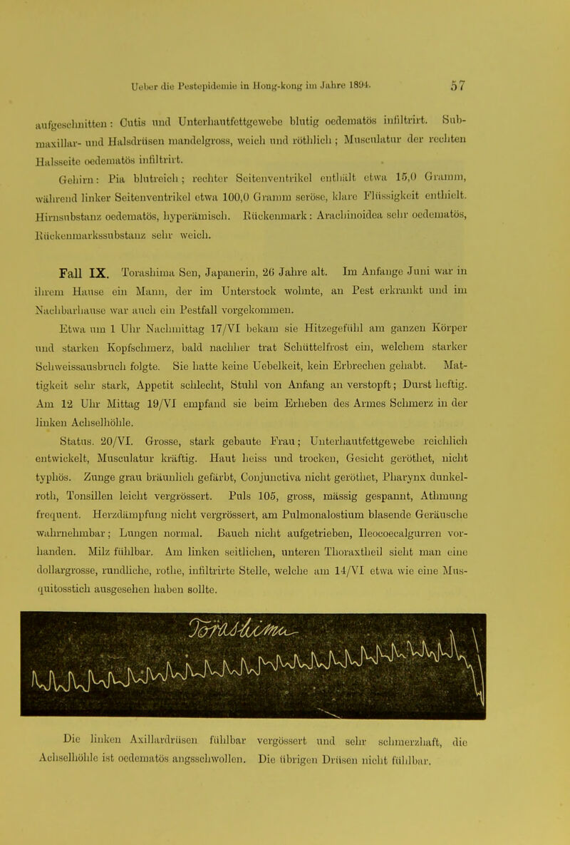 aufgesclmitten: Cutis und Unterhautfettgcwebo blutig oedenmtös infiltrirt. Sub- maxillar- und Halsdrüsen mandelgross, weich und röthlich ; Museulatur der rechten Halsseite oedeniatös infiltrirt. Gehirn: Pia blutreich; rechter Seitenventrikel enthält etwa 15,0 Gramm, während linker Seitenventrikel etwa 100,0 Gramm seröse, klare Flüssigkeit enthielt. Himsnbstanz oedeniatös, hyperämisch. Rückenmark: Arachinoidea sehr oedematös, Rüokenniarkssubstanz sehr weich. Fall IX. Torashima Sen, Japanerin, 20 Jahre alt. Im Anlange Juni war in ihreni Hause ein Mann, der im Unterstock wohnte, an Pest erkrankt und im Nachbarhause war auch ein Pestfall vorgekommen. Etwa um 1 Uhr Nachmittag 17/VI bekam sie Hitzegefühl am ganzen Körper und starken Kopfschmerz, bald nachher trat Schüttelfrost ein, welchem starker Schweissausbruch folgte. Sie hatte keine Uebelkeit, kein Erbrechen gehabt. Mat- tigkeit sein- stark, Appetit schlecht, Stuhl von Anfang an verstopft; Durst heftig. Am 12 Uhr Mittag 19/VI empfand sie beim Erheben des Armes Schmerz in der linken Achselhöhle. Status. 20/VI. Grosse, stark gebaute Frau; Unterhautfettgewebe reichlich entwickelt, Museulatur kräftig. Haut heiss und trocken, Gesicht geröthet, nicht typhös. Zunge grau bräunlich gefärbt, Conjunctiva nicht geröthet, Pharynx dunkel- roth, Tonsillen leicht vergrössert. Puls 105, gross, mässig gespannt, Athmung frequeut. Herzdämpfung nicht vergrössert, am Pulmonalostium blasende Geräusche wahrnehmbar; Lungen normal. Bauch nicht aufgetrieben, Ileocoecalgurren vor- handen. Milz fühlbar. Am linken seitlichen, unteren Thoraxtheil sieht man eine dollargrosse, rundliche, rothe, infiltrirte Stelle, welche am 14/VI etwa wie eine Mus- quitosstich ausgesehen haben sollte. Die linken Axillardrüsen fühlbar vergössert und sehr schmerzhaft, die Achselhöhle ist oedematös angsschwollcn. Die übrigen Drüsen nicht fühlbar.