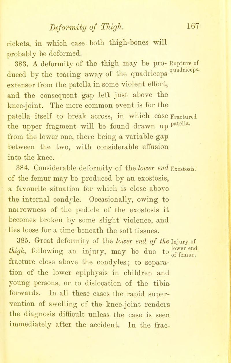 rickets, in which case both thigh-bones will probably be deformed. 383. A deformity of the thigh may be pro- Rupture of duced by the tearing away of the quadriceps qua ncepS' extensor from the patella in some violent effort, and the consequent gap left just above the knee-joint. The more common event is for the patella itself to break across, in which case Fractured the upper fragment will be found drawn up Patella- from the lower one, there being a variable gap between the two, with considerable effusion into the knee. 384. Considerable deformity of the lower end Exostosis, of the femur may be produced by an exostosis, a favourite situation for which is close above the internal condyle. Occasionally, owing to narrowness of the pedicle of the exostosis it becomes broken by some slight violence, and lies loose for a time beneath the soft tissues. 385. Great deformity of the lower end of the Injury of thigh, following an injury, may be due to j,™'™* fracture close above the condyles; to separa- tion of the lower epiphysis in children and young persons, or to dislocation of the tibia forwards. In all these cases the rapid super- vention of swelling of the knee-joint renders the diagnosis difficult unless the case is seen immediately after the accident. In the frac-