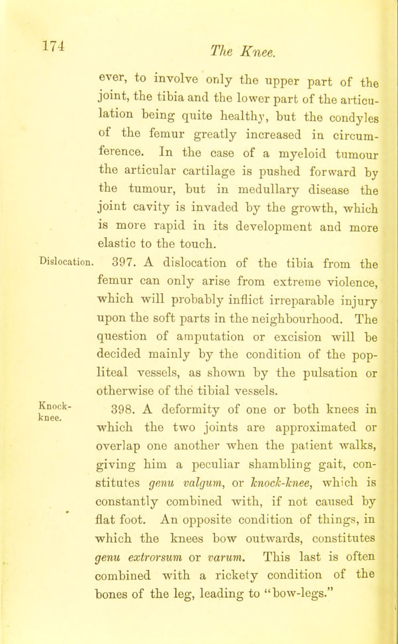 ever, to involve only the upper part of the joint, the tibia and the lower part of the articu- lation being quite healthy, but the condyles of the femur greatly increased in circum- ference. In the case of a myeloid tumour the articular cartilage is pushed forward by the tumour, but in medullary disease the joint cavity is invaded by the growth, which is more rapid in its development and more elastic to the touch. Dislocation. 397. A dislocation of the tibia from the femur can only arise from extreme violence, which will probably inflict irreparable injury upon the soft parts in the neighbourhood. The question of amputation or excision will be decided mainly by the condition of the pop- liteal vessels, as shown by the pulsation or otherwise of the tibial vessels. Knock- 3gg_ deformity of one or both knees in knee. , .J. which the two joints are approximated or overlap one another when the patient walks, giving him a peculiar shambling gait, con- stitutes genu valgum, or Tcnock-Jcnee, which is constantly combined with, if not caused by flat foot. An opposite condition of things, in which the knees bow outwards, constitutes genu extrorsum or varum. This last is often combined with a rickety condition of the bones of the leg, leading to bow-legs.