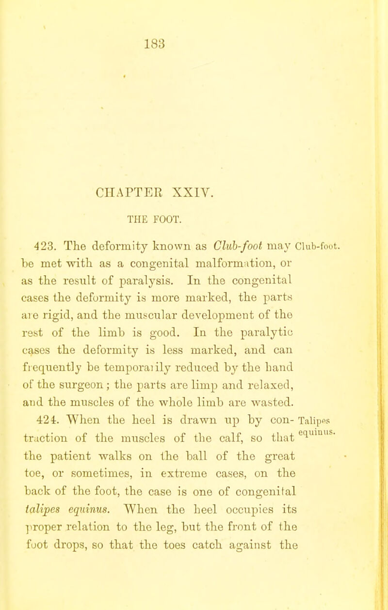 CHAPTER XXIV. THE FOOT. 423. The deformity known as Club-foot may Club-foot, be met with as a congenital malformation, or as the result of paralysis. In the congenital cases the deformity is more marked, the parts are rigid, and the muscular development of the rest of the limb is good. In the paralytic cases the deformity is less marked, and can frequently be temporal ily reduced by the hand of the surgeon; the parts are limp and relaxed, and the muscles of the whole limb are wasted. 424. When the heel is drawn up by con- Talipes traction of the muscles of the calf, so that e1uinus the patient walks on the ball of the great toe, or sometimes, in extreme cases, on the back of the foot, the case is one of congenital talipes equinus. When the heel occupies its proper relation to the leg, but the front of the foot drops, so that the toes catch against the