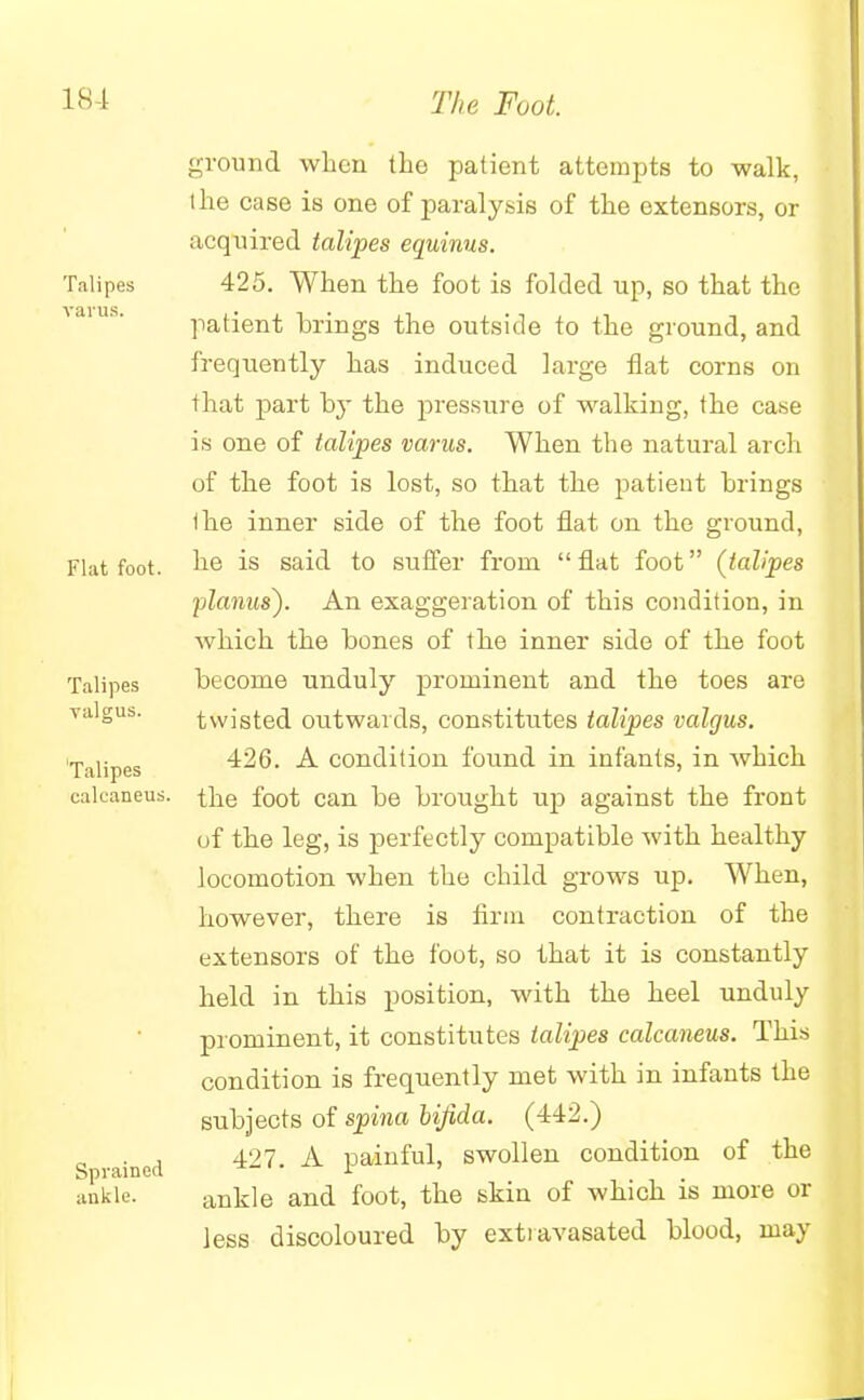 ground when the patient attempts to walk, l he case is one of paralysis of the extensors, or acquired talipes equinus. Talipes 425. When the foot is folded up, so that the patient brings the outside to the ground, and frequently has induced large flat corns on that part by the pressure of walking, the case is one of talipes varus. When the natural arch of the foot is lost, so that the patient brings the inner side of the foot flat on the ground, Flat foot, he is said to suffer from  flat foot (talipes planus). An exaggeration of this condition, in which the bones of the inner side of the foot Talipes become unduly prominent and the toes are valgus. twisted outwards, constitutes talipes valgus. 'Talipes ^26. A condition found in infants, in which calcaneus, the foot can be brought up against the front of the leg, is perfectly compatible with healthy locomotion when the child grows up. When, however, there is firm contraction of the extensors of the foot, so that it is constantly held in this position, with the heel unduly prominent, it constitutes talipes calcaneus. This condition is frequently met with in infants the subjects of spina bifida. (442.) „ . , 4-27 A painful, swollen condition of the Sprained i ' ankle. ankle and foot, the skin of which is more or less discoloured by extiavasated blood, may
