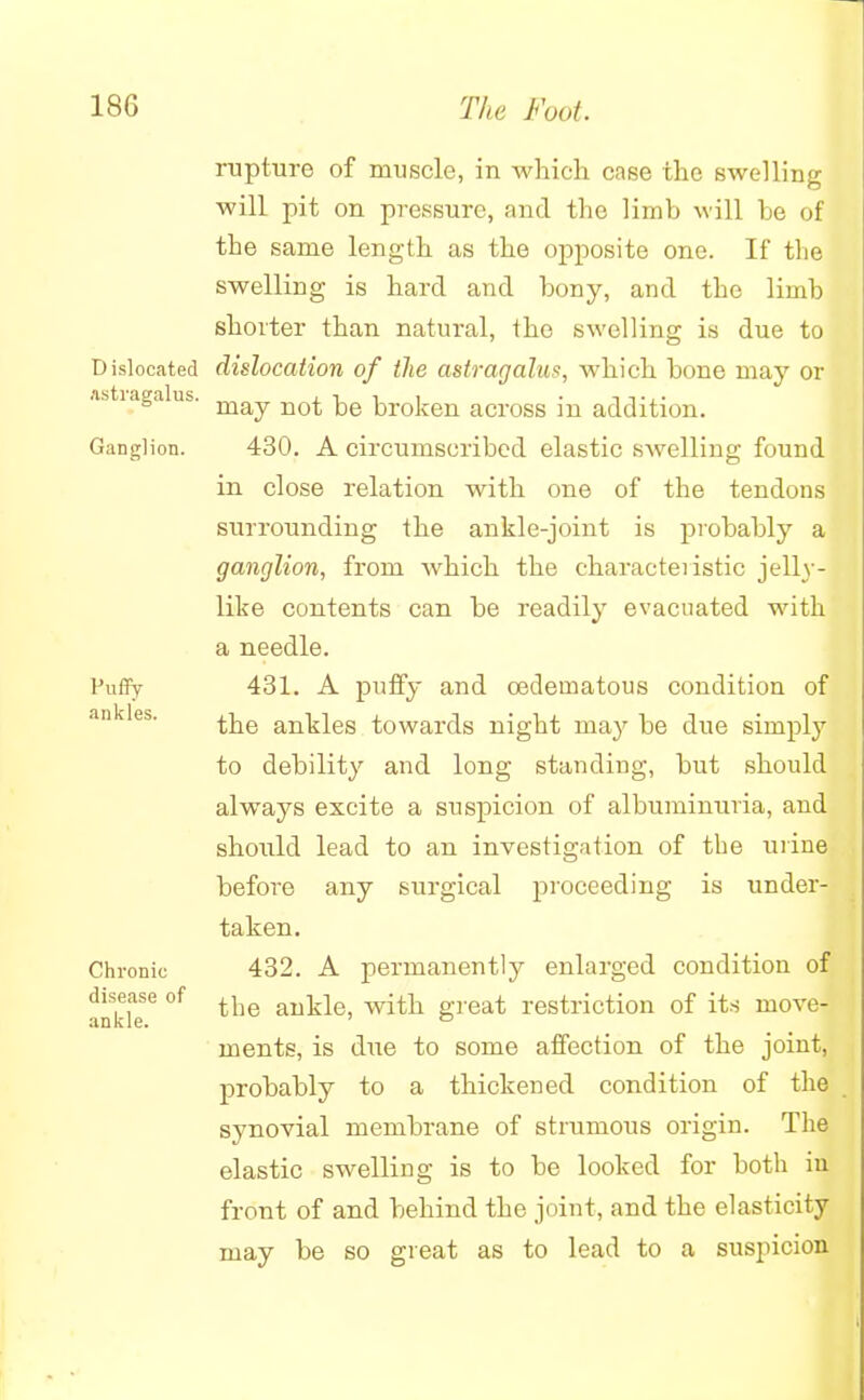 rupture of muscle, in which case the swelling will pit on pressure, and the limb will be of the same length as the opposite one. If the swelling is hard and bony, and the limb shorter than natural, the swelling is due to Dislocated dislocation of the astragalus, which bone may or Abtiagalus. ^ broken across in addition. Ganglion. 430. A circumscribed elastic swelling found in close relation with one of the tendons surrounding the ankle-joint is probably a ganglion, from which the charactei istic jelly- like contents can be readily evacuated with a needle. Puffy 431. A puffy and oedeinatous condition of the ankles towards night may be due simply to debility and long standing, but should always excite a suspicion of albuminuria, and should lead to an investigation of the urine before any surgical proceeding is under- taken. Chronic 432. A permanently enlarged condition of disease of ^ ankle, with great restriction of its inove- ankle. ' ° inents, is due to some affection of the joint, probably to a thickened condition of the synovial membrane of strumous origin. The elastic swelling is to be looked for both iu front of and behind the joint, and the elasticity may be so great as to lead to a suspicion