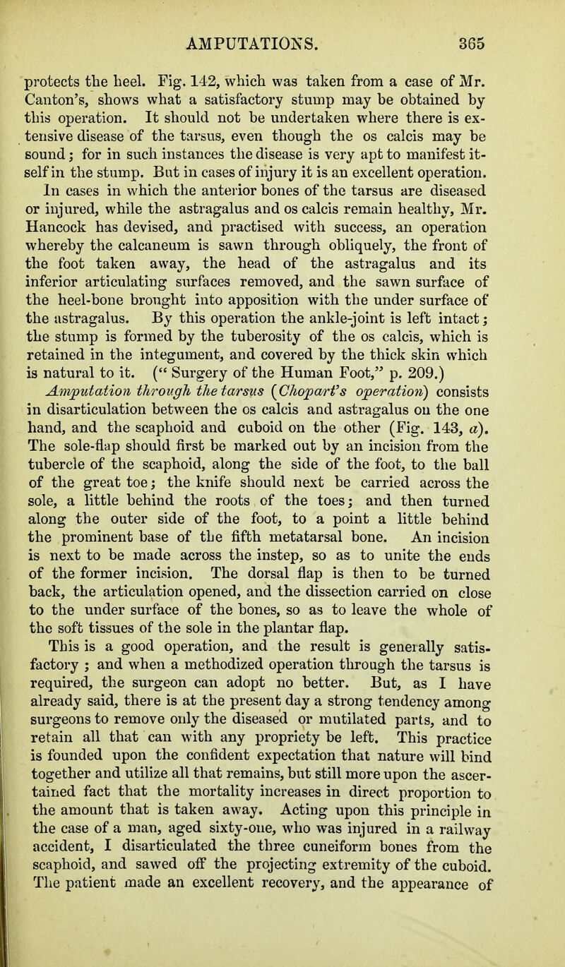 protects the heel. Fig. 142, which was taken from a case of Mr. Canton's, shows what a satisfactory stump may he obtained by this operation. It should not be undertaken where there is ex- tensive disease of the tarsus, even though the os calcis may be sound; for in such instances the disease is very apt to manifest it- self in the stump. But in cases of injury it is an excellent operation. In cases in which the anterior bones of the tarsus are diseased or injured, while the astragalus and os calcis remain healthy, Mr. Hancock has devised, and practised with success, an operation whereby the calcaneum is sawn through obliquely, the front of the foot taken away, the head of the astragalus and its inferior articulating surfaces removed, and the sawn surface of the heel-bone brought into apposition with the under surface of the astragalus. By this operation the ankle-joint is left intact; the stump is formed by the tuberosity of the os calcis, which is retained in the integument, and covered by the thick skin which is natural to it. ( Surgery of the Human Foot, p. 209.) Amputation through the tarsus {Chojpartfs operation) consists in disarticulation between the os calcis and astragalus on the one hand, and the scaphoid and cuboid on the other (Fig. 143, a). The sole-flap should first be marked out by an incision from the tubercle of the scaphoid, along the side of the foot, to the ball of the great toe; the knife should next be carried across the sole, a little behind the roots of the toes; and then turned along the outer side of the foot, to a point a little behind the prominent base of the fifth metatarsal bone. An incision is next to be made across the instep, so as to unite the ends of the former incision. The dorsal flap is then to be turned back, the articulation opened, and the dissection carried on close to the under surface of the bones, so as to leave the whole of the soft tissues of the sole in the plantar flap. This is a good operation, and the result is generally satis- factory ; and when a methodized operation through the tarsus is required, the surgeon can adopt no better. But, as I have already said, there is at the present day a strong tendency among surgeons to remove only the diseased or mutilated parts, and to retain all that can with any propriety be left. This practice is founded upon the confident expectation that nature will bind together and utilize all that remains, but still more upon the ascer- tained fact that the mortality increases in direct proportion to the amount that is taken away. Acting upon this principle in the case of a man, aged sixty-one, who was injured in a railway accident, I disarticulated the three cuneiform bones from the scaphoid, and sawed off the projecting extremity of the cuboid. The patient made an excellent recovery, and the appearance of