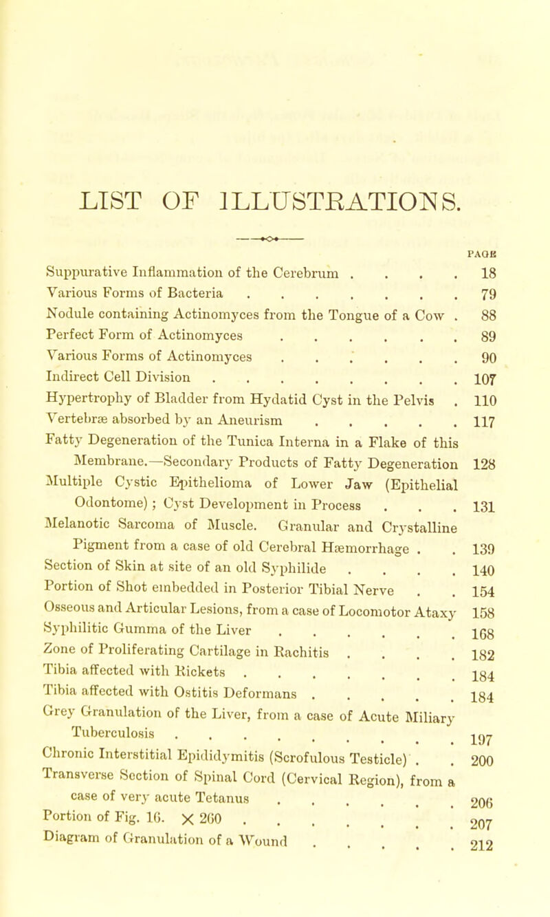 LIST OF ILLUSTRATIONS. PAOE Suppurative Inflammation of the Cerebrum . ... 18 Various Forms of Bacteria ....... 79 Nodule containing Actinomyces from the Tongue of a Cow . 88 Perfect Form of Actinomyces 89 Various Forms of Actinomyces ...... 90 Indirect Cell Division 107 Hypertrophy of Bladder from Hydatid Cyst in the Pelvis . 110 Vertebrae absorbed by an Aneurism 117 Fatty Degeneration of the Tunica Interna in a Flake of this Membrane.—Secondary Products of Fatty Degeneration 128 Multiple Cystic Eijithelioma of Lower Jaw (Epithelial Odontome); Cyst Development in Process . . . 131 Melanotic Sarcoma of I\Iuscle. Granular and Crystalline Pigment from a case of old Cerebral Hsemorrhage . . 139 Section of Skin at site of an old Syphilide .... 140 Portion of Shot embedded in Posterior Tibial Nerve . .154 Osseous and Articular Lesions, from a case of Locomotor Ataxy 158 Syphilitic Gumma of the Liver Igg Zone of Proliferating Cartilage in Rachitis .... 182 Tibia affected with Packets ]^g4 Tibia affected with Ostitis Deformans 184 Grey Granulation of the Liver, from a case of Acute Miliary Tuberculosis -j^gj. Chronic Interstitial Epididymitis (Scrofulous Testicle) . . 200 Transverse Section of Spinal Cord (Cervical Region), from a case of very acute Tetanus 206 Portion of Fig. IG. X 200 ! 207 Diagram of Granulation of a Wound .... 212