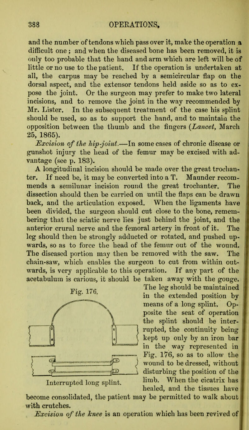 and the number of tendons which pass over it, mate the operation a diflScult one ; and when the diseased bone has been removed, it is only too probable that the hand and arm which are left will be of little or no use to the patient. If the operation is undertaken at all, the carpus may be reached by a semicircular flap on the dorsal aspect, and the extensor tendons held aside so as to ex- pose the joint. Or the surgeon may prefer to make two lateral incisions, and to remove the joint in the way recommended by Mr. Lister. In the subsequent treatment of the case his splint should be used, so as to support the hand, and to maintain the opposition between the thumb and the fingers {Lancet, March 25, 1865). Excision of the hip-joint.—In some cases of chronic disease or gunshot injury the head of the femur may be excised with ad- vantage (see p. 183). A longitudinal incision should be made over the great trochan- ter. If need be, it may be converted into a T. Maunder recom- mends a semilunar incision round the great trochanter. The dissection should then be carried on until the flaps can be drawn back, and the articulation exposed. When the ligaments have been divided, the surgeon should cut close to the bone, remem- bering that the sciatic nerve lies just behind the joint, and the anterior crural nerve and the femoral artery in front of it. The leg should then be strongly adducted or rotated, and pushed up- wards, so as to force the head of the feinur out of the wound. The diseased portion may then be removed with the saw. The chain-saw, which enables the surgeon to cut from within out- wards, is very applicable to this operation. If any part of the acetabulum is carious, it should be taken away with the gouge. The leg should be maintained in the extended position by means of a long splint. Op- posite the seat of operation the splint should be inter- n rupted, the continuity being i ( kept up only by an iron bar i in the way represented in | -= Fig. 176, so as to allow the i ^ wound to be dressed, without j _A disturbing the position of the j Interrupted long splint. ^i™^' When the cicatrix has | healed, and the tissues have j become consolidated, the patient may be permitted to walk about J with crutches. J Excision of the knee is an operation which has been revived ofi